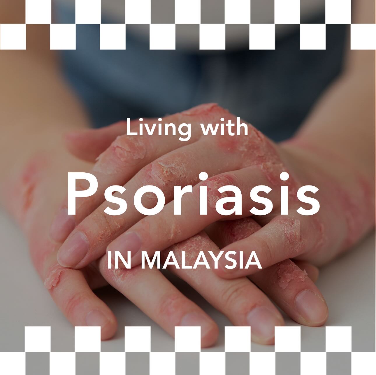 Psoriasis is a long term disease that may be under recognised. You may be living with a friend or family afflicted by the condition. Read on to find out more about how you could help. Blog link in bio