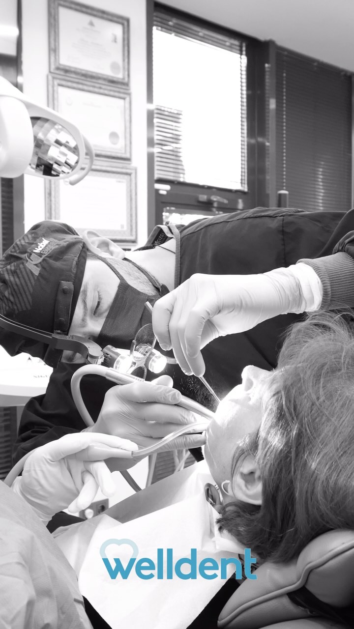 Welldent’te gülüşünüzü yeniden şekillendiriyoruz. 😊🦷
📱 0 216 365 5 365
🖱️ www.welldent.com.tr
📌 Bu paylaşım bilgilendirme amaçlıdır.
Reklam ve rekabet amacı içermemektedir.
#Welldent #SağlıklıGülüşler #BirÖmürTebessüm #WelldentDişKliniği #TatlısuMahallesi #Ümraniye #Şerifali #İstanbul #DişSağlığı #DişHassasiyeti #DişTemizliği #MutluHaftalar #YeniBirGün #Pazartesi