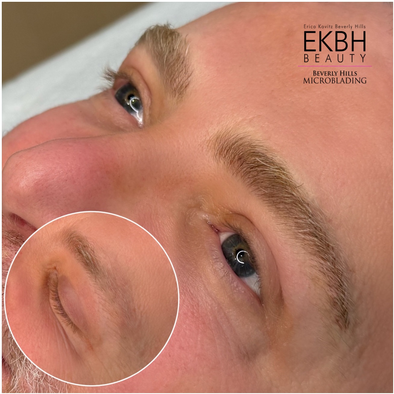 Transforming light brows into naturally defined masterpieces! 🌟 With a touch of nano microblading magic, we’ve added a base and density for a fuller look. Ready to enhance your brows? Text 310-853-0744 to book your session. #NaturalResults #BrowTransformation #MensMicroblading #nanomicroblading