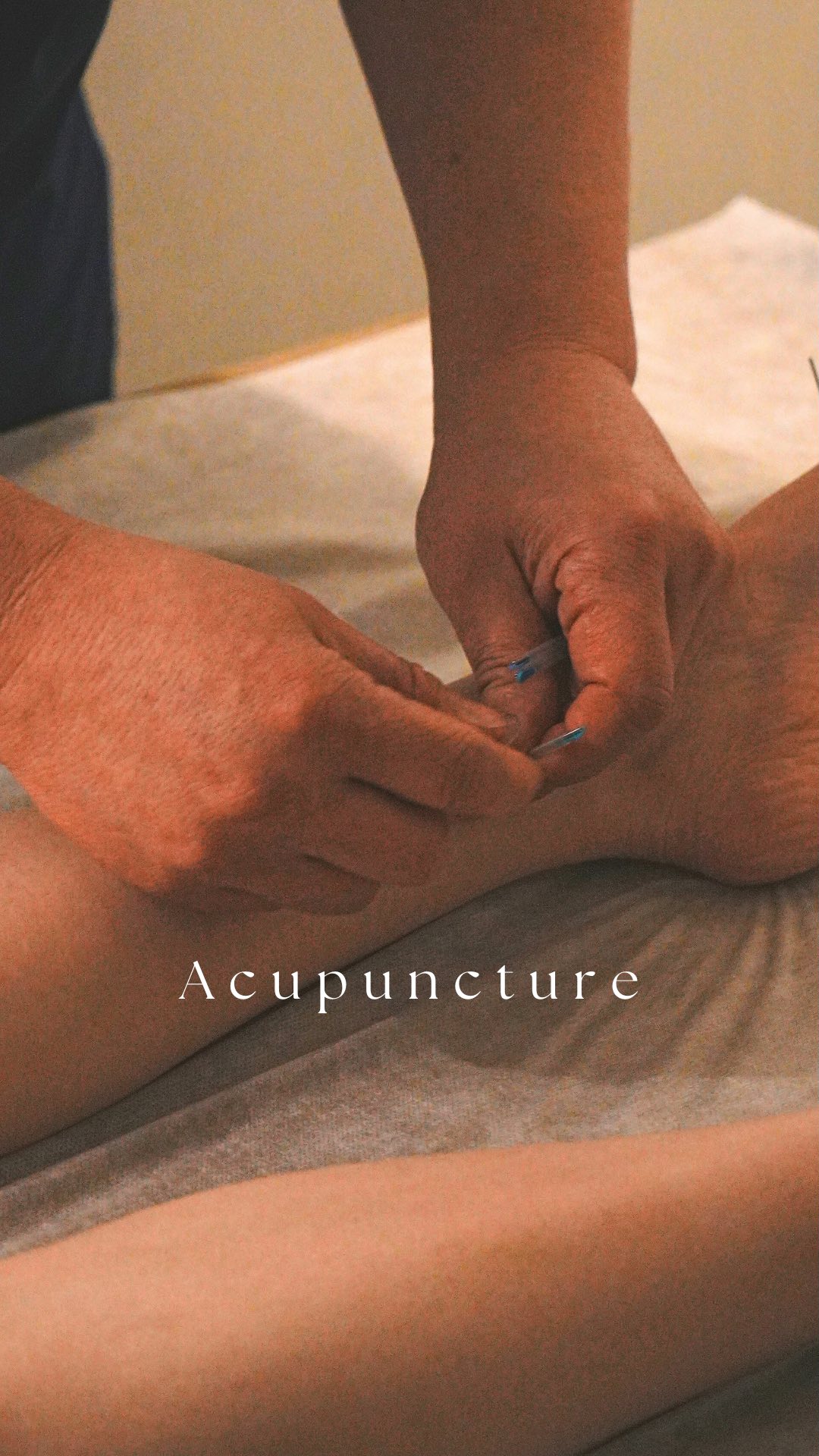 Feeling stressed, fatigued, or dealing with persistent pain? Acupuncture is an ancient healing art designed to restore balance, release tension, and activate your bodyโs natural healing abilities. ๐ชก๐โโ
โ
Relieves muscle pain & tension
โ
Reduces stress & anxiety
โ
Improves sleep & boosts energy
โ
Enhances circulation & overall well-being
Experience deep relaxation and holistic healingโyour body deserves this care. ๐ฟโจ
Book your session today & feel the difference!
๐ Visit us at: 97 Southampton Row, Holborn, London, WC1B 4HH
โ Call us now: 020 8076 8880
๐ WhatsApp: +447881308123
๐ง Email: phcholbornlondon@gmail.com
#TCMP #TraditionalChineseMedicine #Acupuncture
#LymphaticDrainage #AcupunctureHealing
#PainRelief
#ChineseFootTherapy #ChineseNewYear2025
#LondonWellness
#HolbornLondon
#HolbornMassage#ingrownnails#nailfungus#paronychia#Pedicure