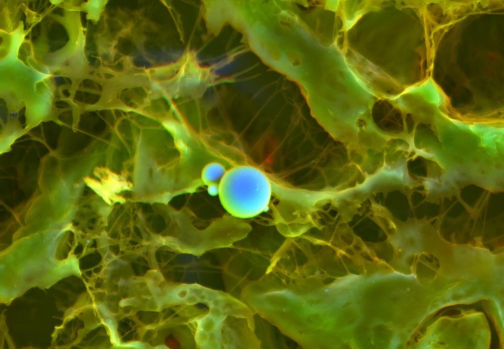 Cardiac calcification #science #electronmicroscope #laboratory #scienceart #sciencephoto #scientific #scienceweek #research #lab #micro #microscope #microscopy #medicine #medicalsciencestudent #medicalstudent #macrophotography #mineralomics #bio #biology #bioimaging #biologylab #minerals #chemistry #material #engineering #physics #sciencecommunication #ucl #DDCSEM #Mineralomics