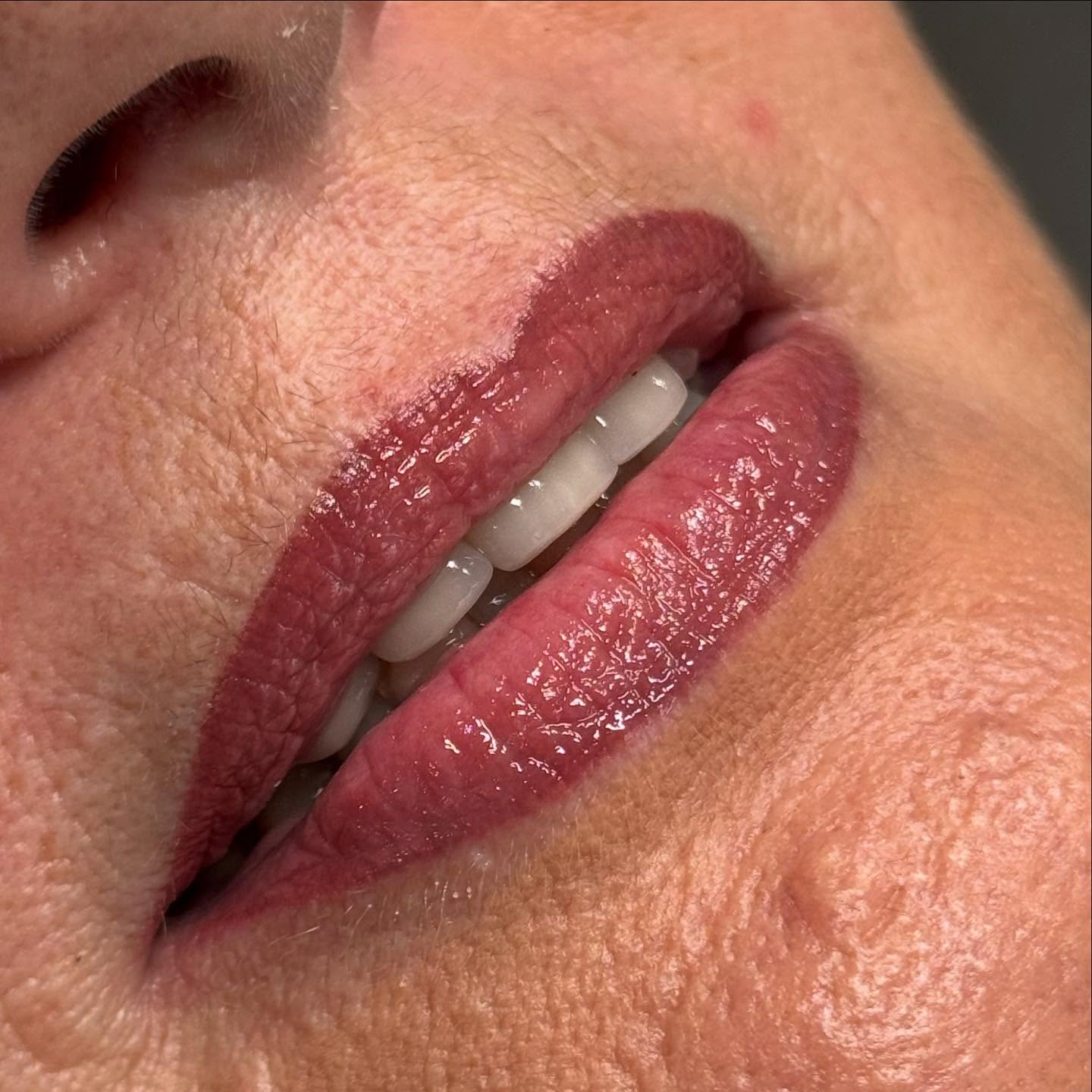 💋 Maquillage Permanent des Lèvres – Pour une bouche sublimée au quotidien ! 💋
Offrez à vos lèvres une teinte éclatante et naturelle grâce à des pigments de haute qualité et une technique experte. 🌸
✨ Produits haut de gamme pour un résultat impeccable ✨
🔹 Pigments utilisés : Red Earth + 1 goutte de Cranberry + 1 goutte de Raspberry de la marque Hanafy pour une teinte harmonieuse et raffinée.
🔹 Matériel professionnel : Aiguille 1RL 0.30 de la marque Kwadron pour une précision extrême et un rendu homogène.
🔹 Sélection de produits signée @permakup.pro , référence en maquillage permanent.
Résultat ? Des lèvres redéfinies, subtilement colorées et un effet naturel longue durée ! 💄
📅 Réservez votre séance dès maintenant et sublimez votre sourire sans effort !
📩 DM pour plus d’infos ou prise de rendez-vous 📍
#MaquillagePermanent #LèvresParfaites #HanafyPigments #Permakup #Kwadron #Esthétique #BeautyAddict