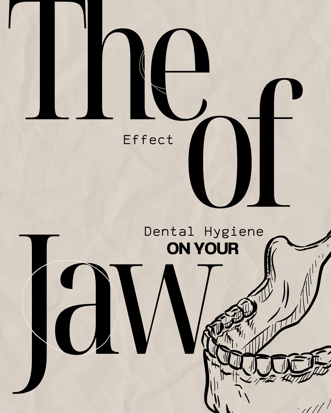 🦷 Did you know that
neglecting your dental hygiene
can actually weaken your jaw?
When gum disease goes
untreated, it can lead to bone
loss, affecting the strength and
structure of your jaw.
But don’t worry, brushing,
flossing, and regular dental
check-ups can keep your smile
(and jaw!) strong. 😁
#drtooth #jawhealth #oralcare
#gumdisease #strongteeth