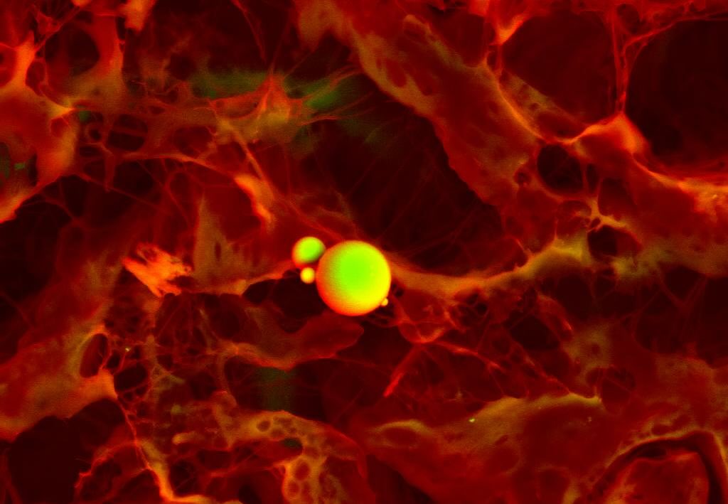 Cardiac calcification #science #electronmicroscope #laboratory #scienceart #sciencephoto #scientific #scienceweek #research #lab #micro #microscope #microscopy #medicine #medicalsciencestudent #medicalstudent #macrophotography #mineralomics #bio #biology #bioimaging #biologylab #minerals #chemistry #material #engineering #physics #sciencecommunication #ucl #DDCSEM #Mineralomics