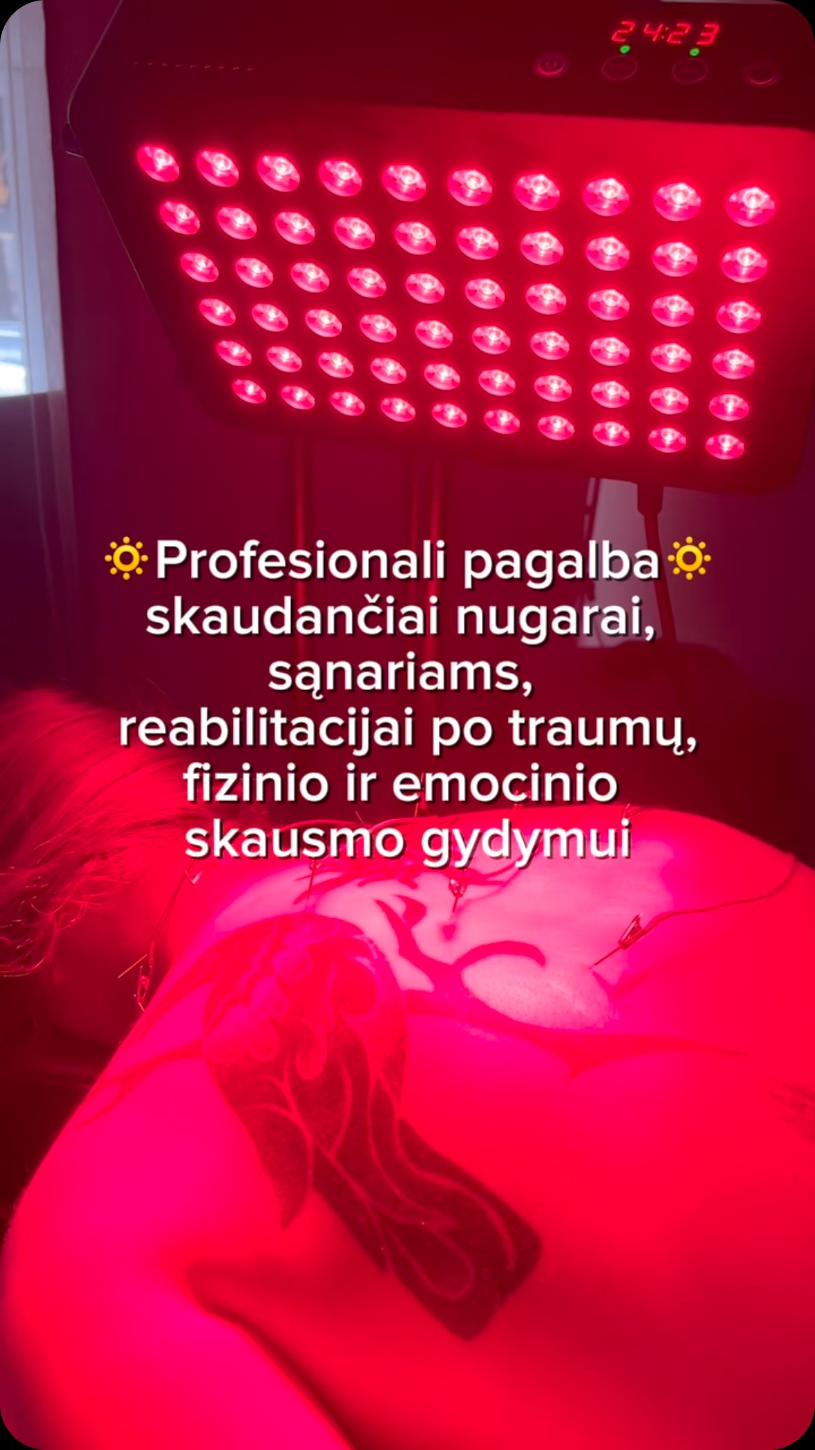 #akupunktura #skausmas #sportas #terapija #trauma #gydymas #masazas