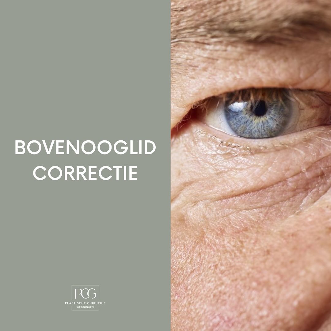 Het komt vaak voor dat de huid en spieren rond de ogen verslappen. Dit hoeft niet altijd het gevolg te zijn van het ouder worden. Uw gezichtsuitdrukking komt dan niet overeen met hoe u zich voelt. Door middel van een (boven)ooglidcorrectie lossen onze ervaren plastisch chirurgen dit voor u op!
Wilt u meer informatie betreft de mogelijkheden voor een ooglidcorrectie? Neem dan snel contact met ons op!
📞: 050 - 211 04 96
💌: info@pcgroningen.nl