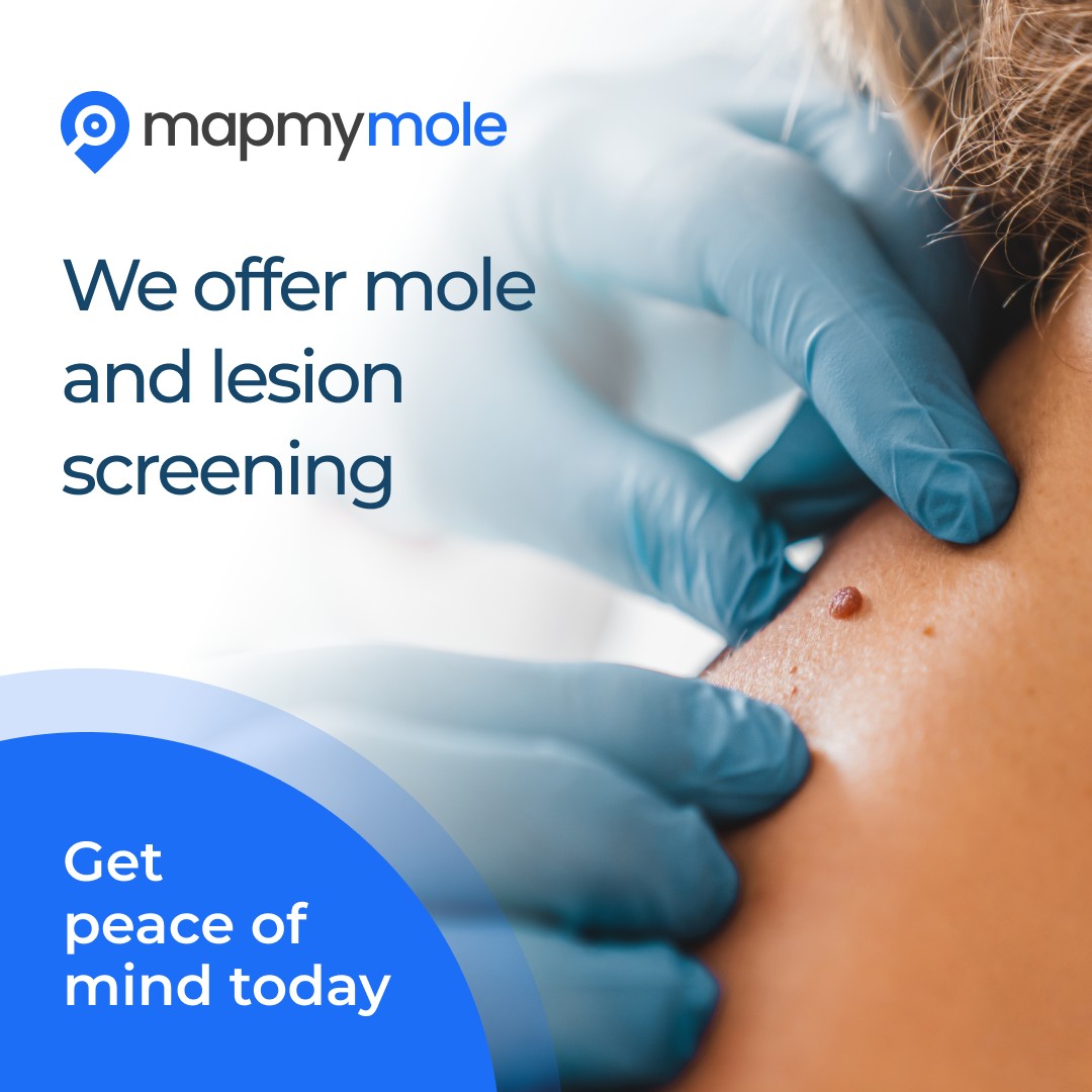 We now offer mole and lesion screening with Map My Mole.
Map My Mole offers an accessible screening service at skin clinics like The Expert Skin Clinic. It works by taking a photograph with a professional-grade Dermatoscope that is then sent off to be further analysed.
A dermatologist will review the images within 48 hours and provide a report. We will then contact you to discuss the results and next steps.
Traditional referrals for lesion or mole concerns can be expensive with long wait times. This service is revolutionising the way people have their moles checked and contributing to earlier detection and prevention of skin cancer.
Whilst this service is not intended to diagnose skin cancer, it helps us to identify moles or lesions that may be a cause for a concern before removal or further assessment is actioned.
This service costs £150 for an evaluation of up to 3 moles or lesions and can be booked on our website by clicking on the 'book now' button and navigating to 'mole/lesion screening'.
Let us know if you have any questions!
#molescreening #molescreeningclinic #mapmymole #molescreeningnorthampton #mapmymolenorthamptonshire