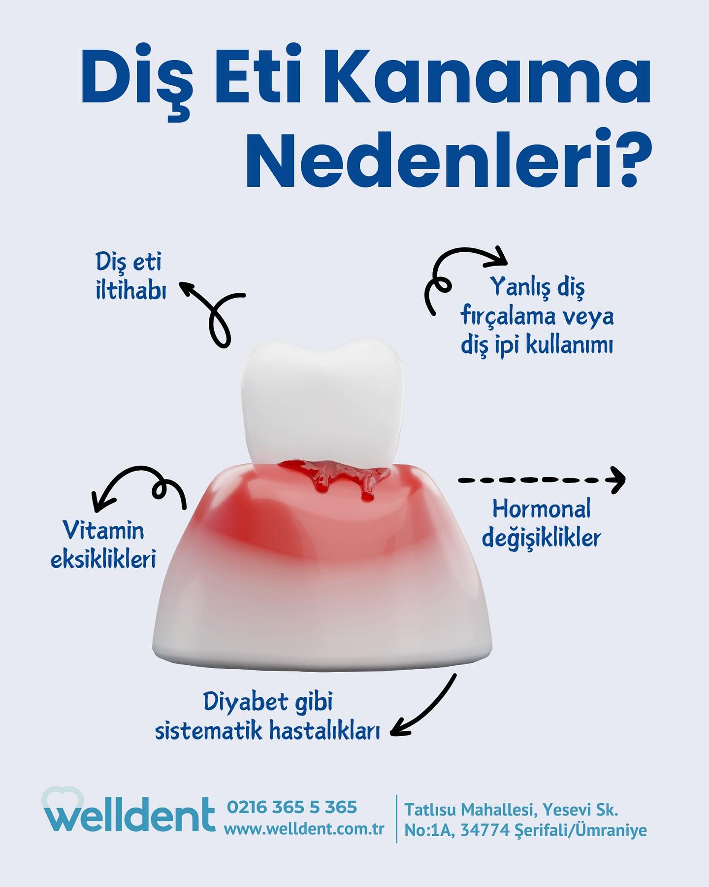 Diş Eti Kanama Nedenleri? 🦷
Diş sağlığınız için, kliniğimizi ziyaret etmeyi unutmayın. 😊
#Welldent #SağlıklıGülüşler #BirÖmürTebessüm
#WelldentDişKliniği #TatlısuMahallesi #Ümraniye
#Şerifali #İstanbul #DişSağlığı #DişHassasiyeti #DişTemizliği #DişEti #DişEtiHastalıkları #DişAğrısı #WelldentBilgiler