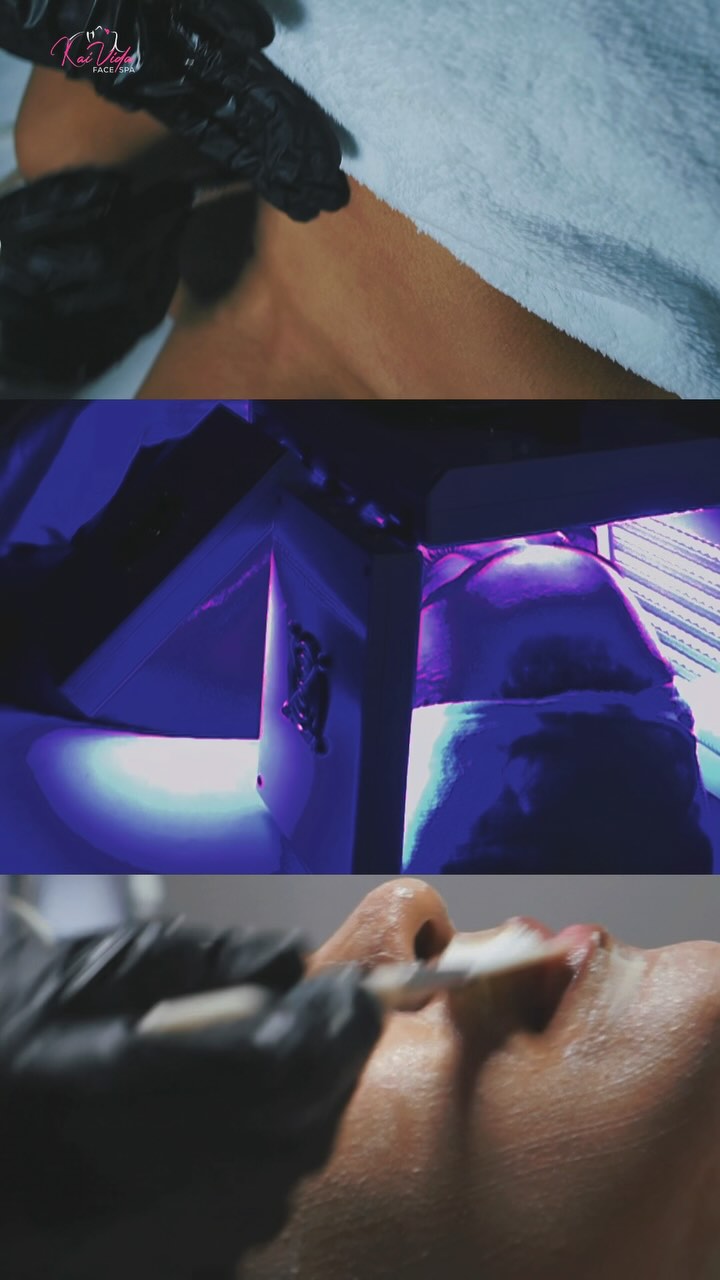 ✨ Kai Vida Face Spa – Where Your Face is the Focus! ✨
Experience the power of medical-grade skincare technology, designed to rejuvenate, lift, and restore your skin like never before. Step into Kai Vida Face Spa and indulge in the personalized care you deserve. We focus on your skin’s unique needs, your relaxation, and tailor every treatment just for you.
💡 @lightwavetherapy LED Light Therapy – Clinically proven to:
✔ Boost collagen production for firmer, youthful skin
✔ Reduce wrinkles & fine lines by stimulating skin renewal
✔ Improve acne & inflammation with blue light antibacterial action
✔ Accelerate healing & even skin tone for a radiant complexion
⚡ @7emyolift Microcurrent Facial – The ultimate non-invasive facelift:
✔ Lifts & sculpts facial muscles for a contoured, youthful look
✔ Enhances circulation & lymphatic drainage to reduce puffiness
✔ Stimulates ATP production (cell energy) for skin repair & renewal
✔ Boosts product absorption to maximize skincare benefits
And that’s just the beginning! 💖 We offer exclusive, advanced treatments that make Kai Vida Face Spa the flagship destination face spa in New Jersey.
📍 Book your experience today & discover your best skin yet.
#kaividafacespa #mendhamnj #spanj #bernardsnj #LEDLightTherapy #MicrocurrentFacial #CollagenBoost #destinationspa #morriscountynj #facials #facespa #acnetreatment #antiaging #oxygenfacial #lighttherapy #microcurrent #microcurrentfacelift