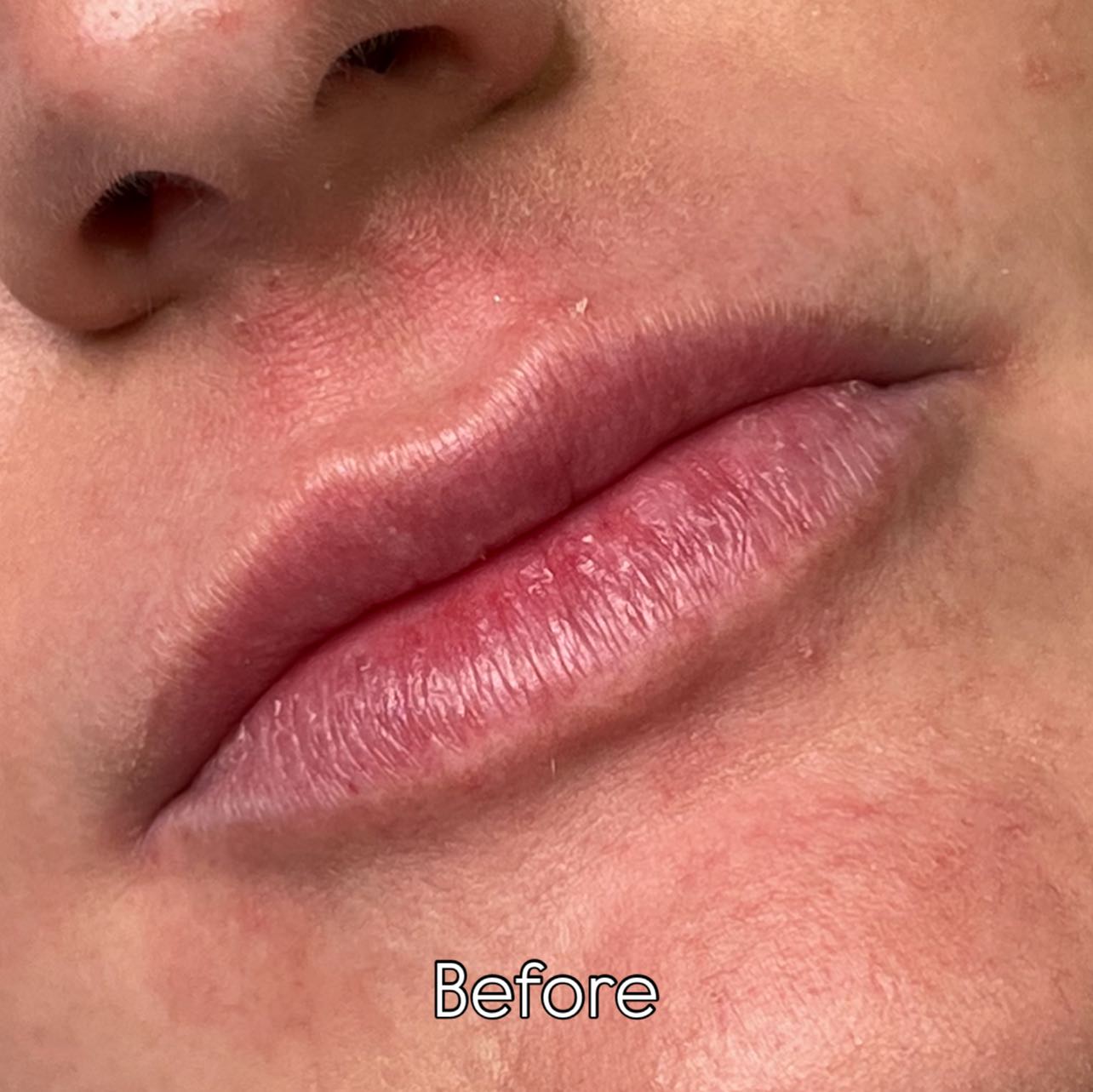 LIPS 💖 turning these lips more pink. So subtle but such a difference. Really made them look healthier. Was so hard to catch it on camera. I need to become a photographer 😅