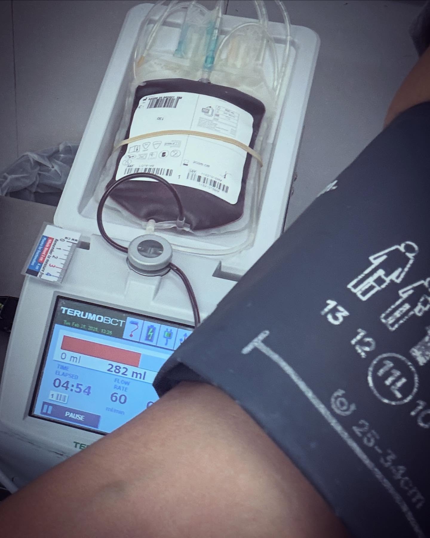 Donated Blood Today! 🩸❤️
It feels great to know that a small act can make a big difference! #IGaveBlood #SaveLives #DonateBlood