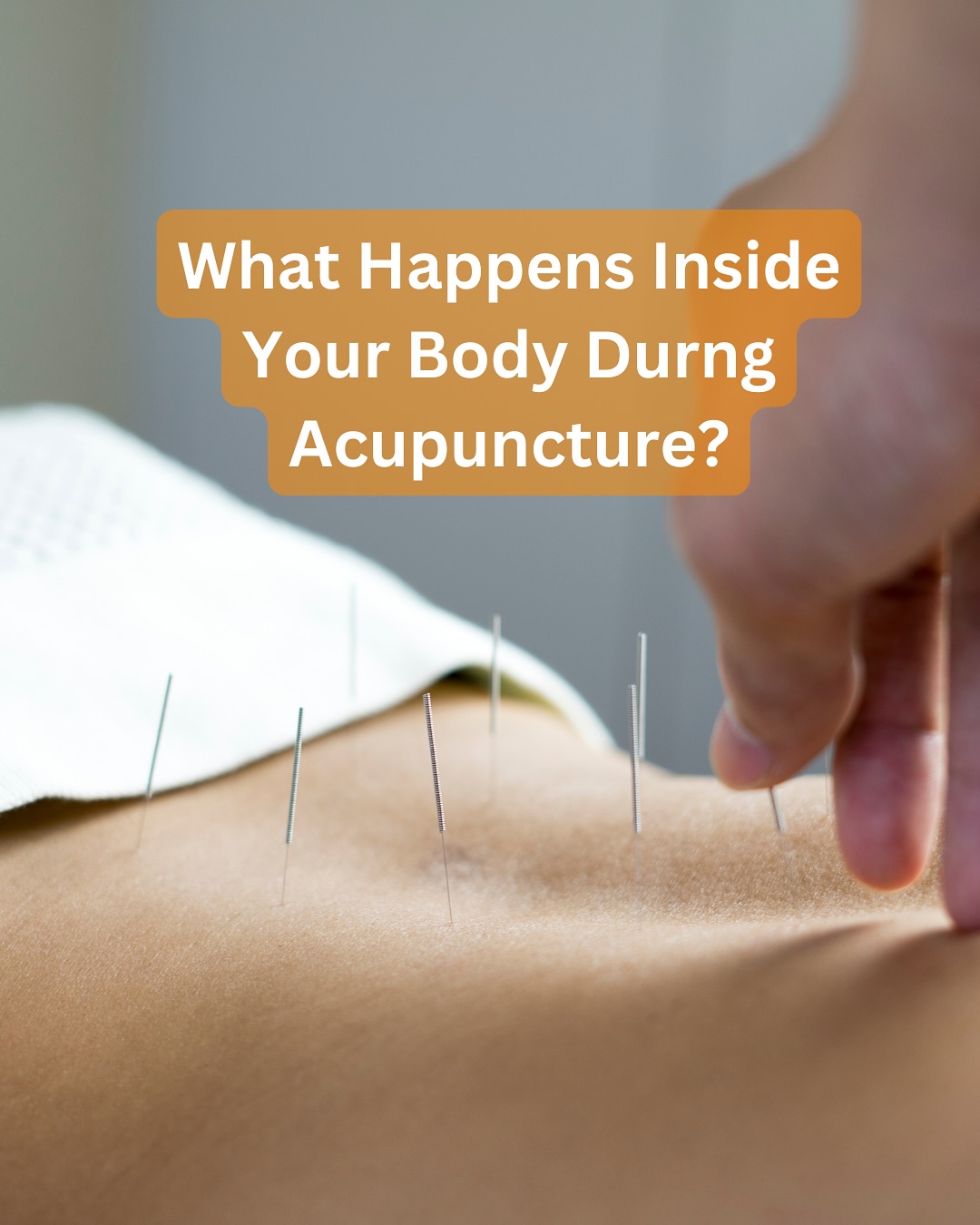 What Happens in Your Body During Acupuncture?
Acupuncture is more than just needles—it triggers powerful physiological changes that support whole-body health. Here’s how it works:
* Calms the nervous system – Activates the parasympathetic (rest-and-digest) response, reducing stress and promoting relaxation
* Optimises digestion – Supports gut motility, reduces bloating, and enhances nutrient absorption
* Supports liver detox & lymphatic clearance – Improves circulation, clears stagnation, and aids toxin elimination
* Balances hormones – Regulates the endocrine system, supporting menstrual health, fertility, and skin conditions
* Boosts immunity & adrenal function – Modulates inflammation, strengthens immune defenses, and prevents burnout
* Supports skin barrier repair & oil regulation – Enhances microcirculation, reduces inflammation, and helps with acne-prone skin
Acupuncture works by restoring balance from the inside out, helping your body function at its best.
#acupuncture #traditionalchinesemedicine #holistichealth #gutskinhormone #hormonalhealth #stressrelief #acnehealing #lymphatichealth #naturalhealing #skinhealth