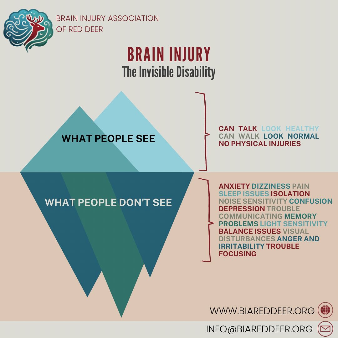 The Iceberg Model is a metaphor used to illustrate how many symptoms of brain injury are concealed beneath the surface, similar to how most of a real iceberg remains submerged beneath the water.
The visible part above the surface represents what āoutsidersā may perceive: you appear normal, speak, walk, therefore are okay. However, these visible aspects constitute only a small portion of what actually transpires within an individual with a brain injury.
This model helps us understand that there is much more to brain injury than what we can observe. Just because someone appears okay does not necessarily mean they are.
The Brain Injury Association of Red Deer (BIARD) wants to help you through your brain injury journey by providing 1-1 support, education, and advocacy. For more information visit us at www.BIARedDeer.org, message us on instagram, or send us an email: info@biareddeer.org.