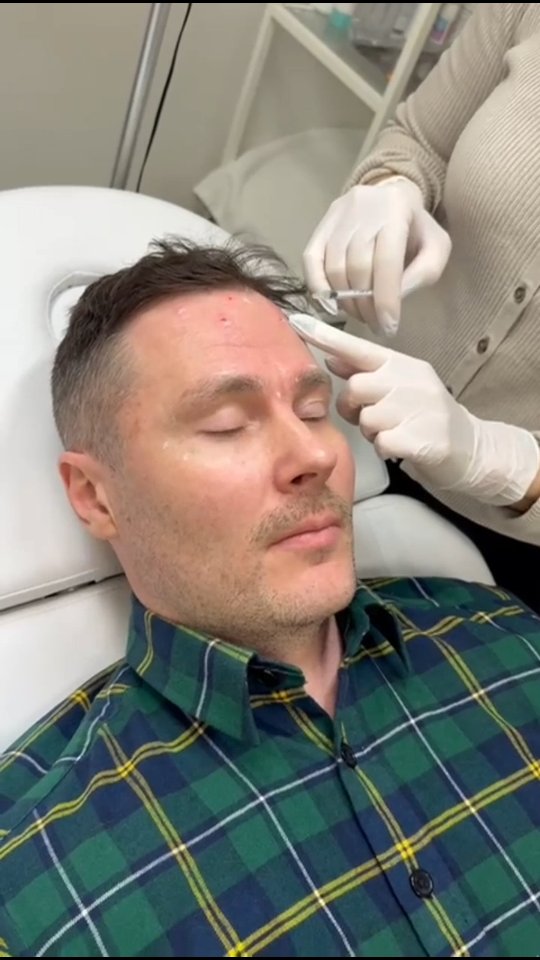 Botuliini hoito toimii myös miehillä. Varsinkin otsan ja silmäkulmien juonteiden ennalta ehkäisemiseksi! ⭐️
#botox
#turku