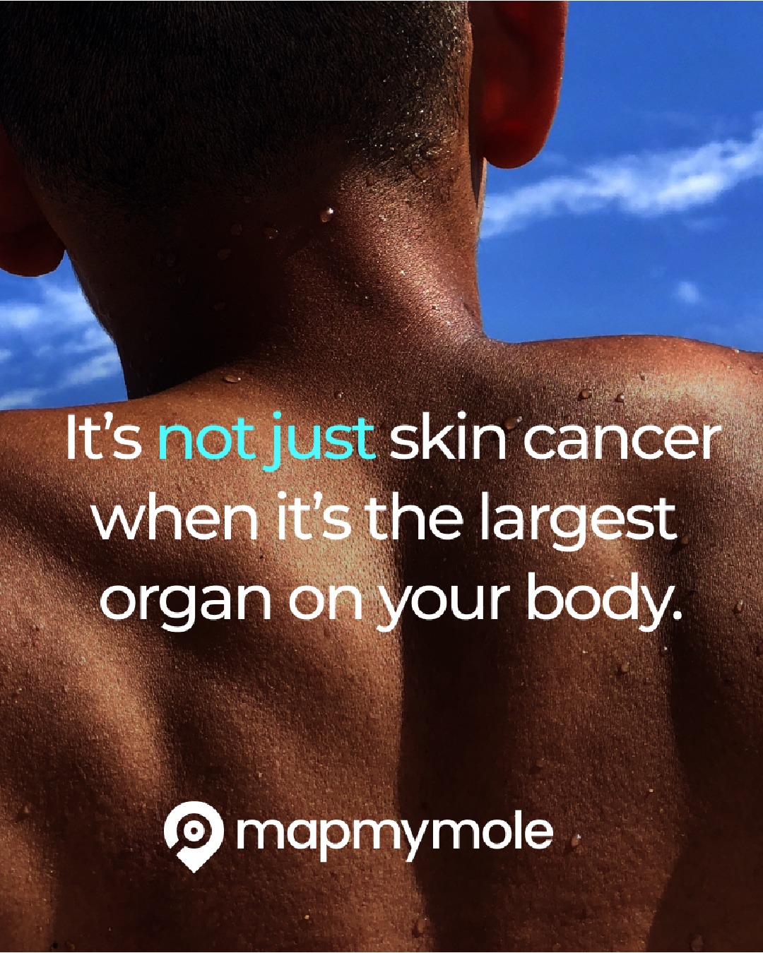 We're so pleased to see more discussion around skin cancer, checking your skin and looking out for any changes.
It isn't 'just' skin cancer. Your skin is the largest organ on your body and skin cancer is one of the most common types of cancer.
Due to the subtly of its appearance in lots of cases, it is often missed and people can live with skin cancer for years without knowing.
This is why checking your skin and keeping an eye on any new or changing blemishes is essential. Early diagnosis saves lives and the sooner you get a concerning or changing skin blemish checked, the the better the chance of it being treatable.
We're proud to offer the Map My Mole service, providing more affordable, detailed skin checks. If you have a skin blemish or mole you're concerned about, book a 'mole/lesion screening' on our website.
#mapmymole #molescreening #molescreeningclinic #skincancerscreening #skincancer