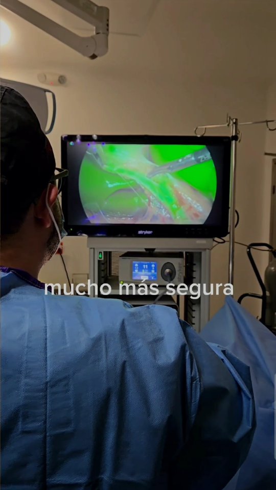 El Sr. Manuel llegó a nosotros con molestias persistentes resulto en un diagnóstico de cálculos biliares.
Gracias a la cirugía laparoscópica con verde de indocianina, pudimos realizar una extracción de vesícula precisa, segura y con mínima invasión.
✅ Mayor seguridad durante la cirugía
✅ Identificación precisa de las vías biliares
✅ Recuperación más rápida y efectiva
Con esta tecnología, garantizamos mayor precisión y mejores resultados, reduciendo riesgos y optimizando la recuperación de nuestros pacientes.
📲 Si tienes síntomas de problemas en la vesícula, agenda tu consulta gratuita hoy mismo. Tu salud es prioridad.
📞 +52 332 495 9368
📞 +1 619 639 3034
🌐 www.drweightlosstijuana.com
#CirugíaDeVesícula #LaparoscopiaAvanzada #DrWeightLossTijuana #SeguridadQuirúrgica #SaludDigestiva #VerdeDeIndocianina #RecuperaciónRápida