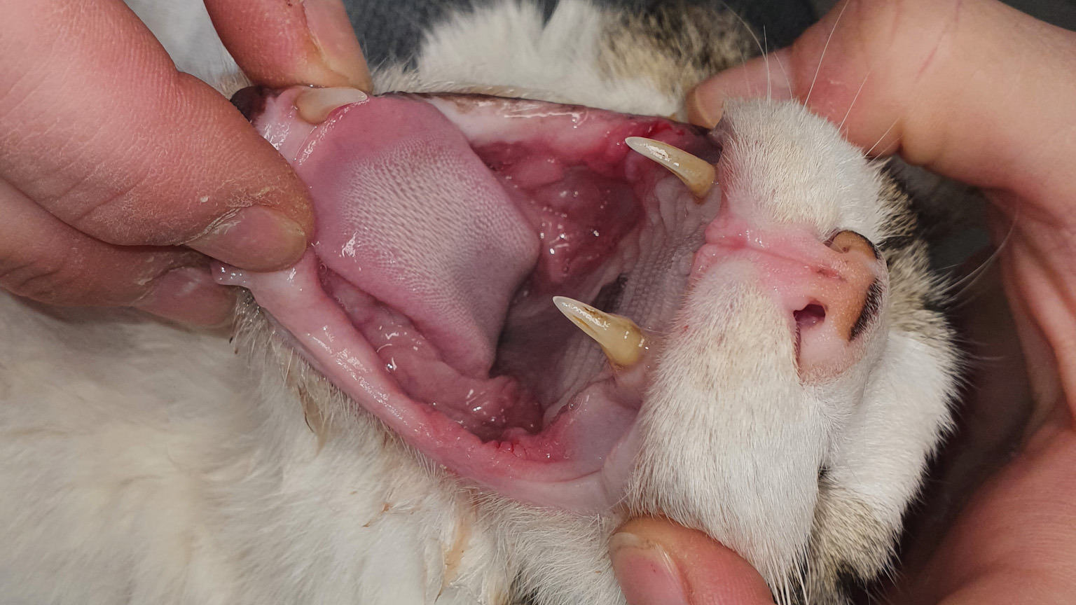 Ende letzten Jahres wurde uns der 9jährige Kater "Charlie" mit einer hochgradig entzündeten und sehr schmerzhaften Mundhöhle (Gingivostomatitis) vorgestellt. Charlie wurde schon längere Zeit mit Medikamenten behandelt, doch schlugen die nicht ausreichend an und er hatte starke Schmerzen bei der Nahrungsaufnahme und beim Putzen: er hatte deutlich an Körpergewicht abgenommen und sein Fell war glanzlos.
Im Dezember 2024 erfolgte dann bei uns eine eingehende Untersuchung der Mundhöhle in Inhalationsnarkose inklusive Dentalröntgen. Offensichtlich hatte Charlie noch drei Zähne im Mund und das Dentalröntgen hat dann die Wahrheit ans Licht gebracht: in zwei Sitzungen haben wir Charlie sämtliche Zähne und Zahnwurzelreste entfernt und eine Tupferprobe genommen. Die PCR-Untersuchung ergab eine Calici-Virus Infektion.
Charlie ging es nach der ersten Sitzung direkt viel besser. Er bekam das Schmerzmittel als subkutane. Injektion. Schon nach zwei Wochen hatte er an Körpergewicht zugenommen und putzte sich wieder. Im darauffolgenden Monat haben wir die zweite Mundhöhlenhälfte behandelt und Charlie hat mittlerweile 600g zugenommen und benötigt nur noch alle drei Tage Schmerzmittel.
Nun bekommt er vom Haustierarzt eine Therapie mit einem Interferon, dass er täglich tropfenweise in den Mund bzw mit dem Futter bekommt. Es ist wichtig dass das Medikament in einer fetthaltigen Lösung verabreicht wird.
Wenn er darunter gar kein Schmerzmittel mehr benötigt, dann wird er diese Therapie zunächst für zwölf Monate bekommen.
Bild 1 (es sind noch offensichtlich 3 Zähne in der entzündeten Mundhöhle vorhanden)
Bild 2 (der linke Unterkieferfangzahn befindet sich zur Hälfte noch im Zahnfach. Es sind viele Zahnwurzelreste im Ober- und Unterkiefer vorhanden)
Bild 3 (alle Wurzelreste und Zähne werden entfernt)
Bild 4 (3 Wochen nach der zweiten Sitzung der Zahnsanierung. Charlie geht es viel besser aber die Entzündung durch die Virusinfektion ist noch deutlich erkennbar)
