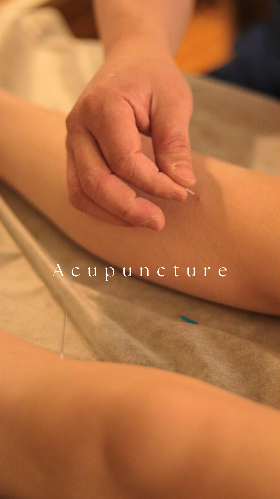 Acupuncture isn’t just another appointment—it’s a reset for your body & mind. 🌿💆♀
✔ Relieves pain & tension
✔ Reduces stress & anxiety
✔ Improves sleep & energy
✔ Restores balance naturally
Feel lighter, calmer, and recharged. ✨
📍 Holborn, London | DM us to book your session!
#AcupunctureHealing #TCMWellness #HolisticHealth #StressRelief #PainRelief #SelfCareRitual #HolbornWellness