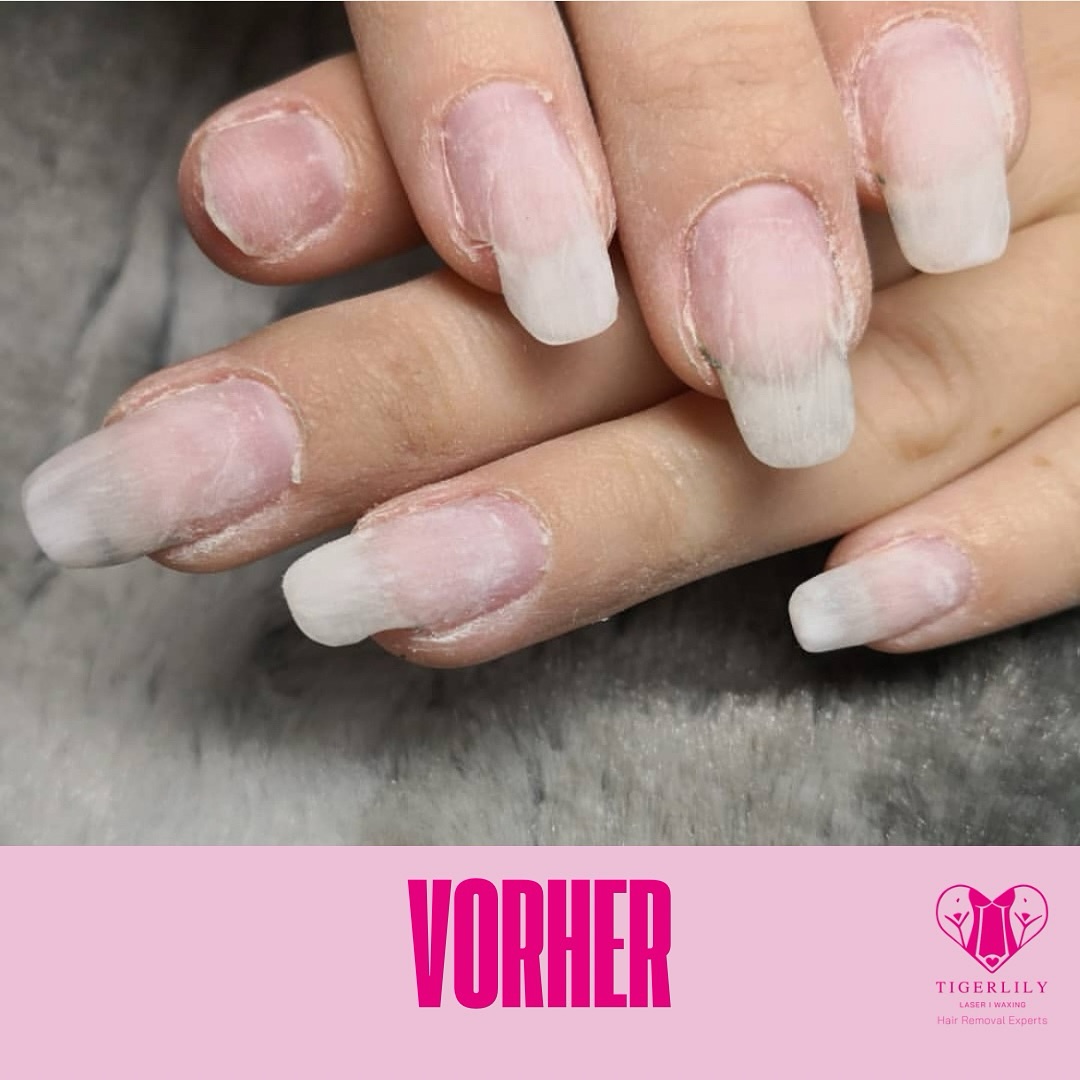 ✨ NEU BEI UNS: PROFESSIONELLES NAGELDESIGN ✨
Du liebst perfekte Nägel? Dann bist du bei uns genau richtig! 💅🏼 Ab sofort kannst du dir bei Tigerlily traumhafte Nägel zaubern lassen – von klassisch elegant bis hin zu kreativen Designs.
📸 Swipe nach rechts und sieh dir die unglaublichen Vorher-Nachher-Ergebnisse an!
🔹 Natürliche Maniküre
🔹 Gel- und Acrylmodellage
🔹 Trendige Nailart
🔹 Verstärkungen & Reparaturen
💖 Gönn dir den perfekten Look – jetzt Termin sichern!
📍 Uhlandstraße 138, Berlin
📩 DM für Termine oder buch direkt über den Link in unserer Bio!
#NageldesignBerlin #BeautyLounge #PerfectNails #BerlinBeauty #Selfcare