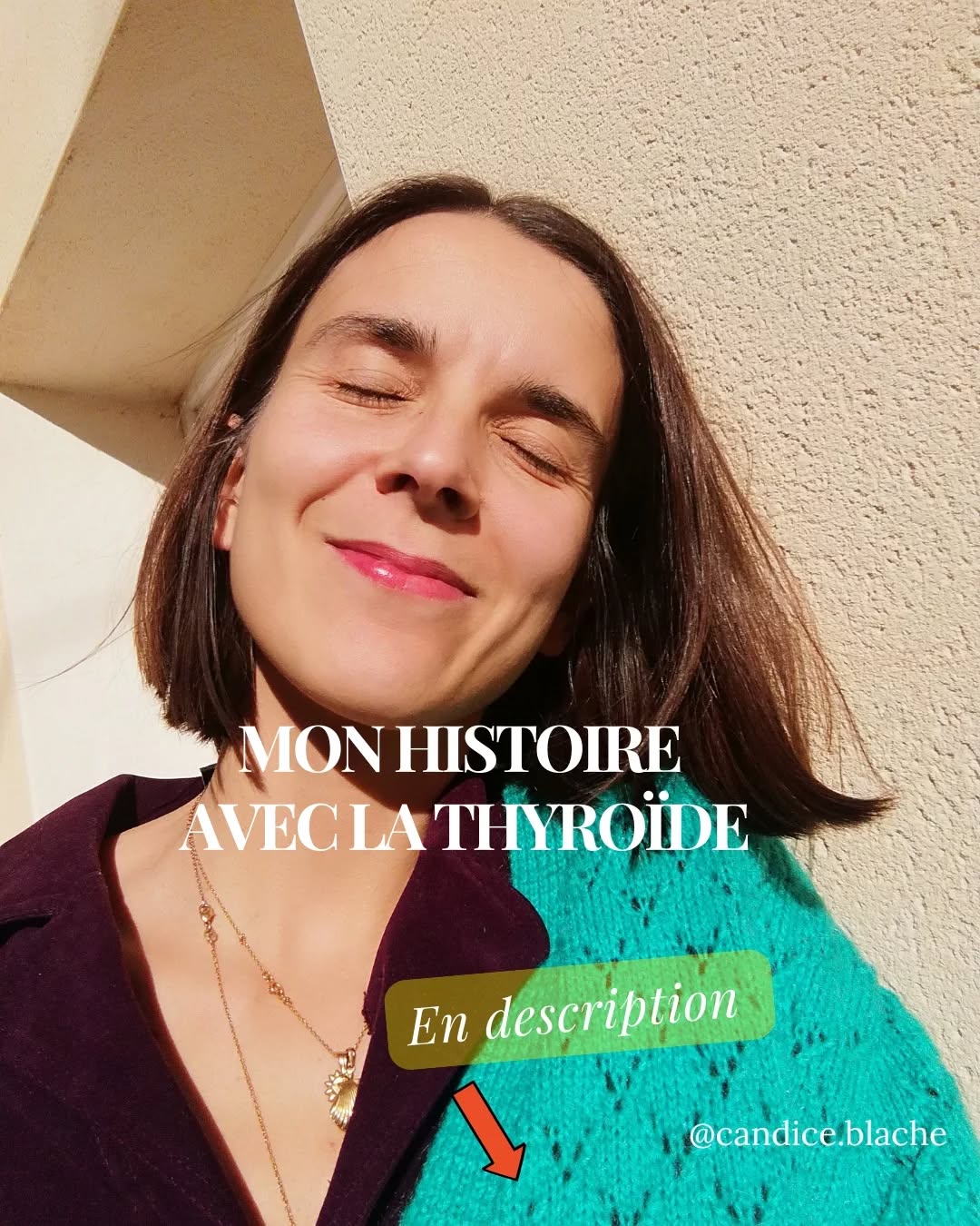 ⬇️⬇️⬇️⬇️ MON HISTOIRE
🦋🦋
On m'a détecté une hypothyroïdie en 2012, à l'époque j'ai un gros bilan sanguin à faire car je tombe de fatigue (je suis étudiante à Sciences Po Lyon) et je me couche parfois à 18h30/19h jusqu'à 7h le lendemain..
Une TSH (hormone hypophysaire qui stimule la production des hormones thyroïdiennes T3 et T4) à plus de 8 qui se solde par un diagnostic rapide et sans appel. Un ralentissement thyroïdien soit un ralentissement global de mon métabolisme.
🦋🦋
Bonne nouvelle ? Cela se soigne facilement et les effets sont rapides. 🚀
Mauvaise nouvelle ? Le traitement est à vie selon la médecine allopathique. 😢
🦋🦋
La thyroïde c'est une glande endocrine (qui secrète des hormones thyroïdiennes) en forme de papillon qui régule les niveaux d'énergie dans le corps selon ses besoins et qui est vraiment complexe tant elle agit sur la sphère physique que psychique.
🦋🦋
Quand on est en hypo c'est tout l'organisme qui ralentit..Constipation, infections à répétition car baisse de l'immunité, gros troubles de l'humeur et parfois état depressif, troubles du cycle et de la fertilité, migraines, prise de poids etc.. 🌀
🦋🦋
La thyroïde a besoin de plein de cofacteurs pour fonctionner normalement : iode, vitamine d, vitamine a et toutes les b, fer, selenium, l tyrosine, magnésium etc... Bon voilà pour le tableau rapide mais bien sûr c'est beaucoup plus COMPLEXE que ça 😬 avec une grosse composante psycho émotionnelle à ne pas négliger 😏
🦋🦋
Pendant 4 ans, je prends mon 💊 chaque matin, sans trop me poser de questions jusqu'à ma prise de conscience en 2016/2017 qui commence autour de la santé et de la nutrition.
J'arrête la pilule contraceptive fin 2016 et s'en suit 4 ans et demi d'aménorrhée (vous allez comprendre ensuite le lien 😊) ponctuées d'anorexie..
🦋🦋
Dans mon élan, j'ai aussi envie de trouver des alternatives naturelles à la chimie pour ma thyroïde mais je sens (et on me confirme) que ça peut faire beaucoup de travail (retour de mon cycle et arrêt de mon 💊) pour mon corps donc je PRIORISE le retour de mes lunes ✨
⬇️⬇️⬇️⬇️ SUITE EN COMMENTAIRE
