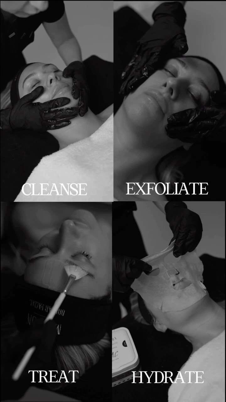 🫧Oxygenate, hydrate and rejuvenate your skin with the Oxy-Pro Facial 🫧
This treatment combines science with facial yoga for the ultimate glow-boosting treatment 🧘♀️
Working to increase oxygen within the skin to combat acne, sensitivity and ageing by hydrating the skin and killing bacteria 🦠
Incorporating facial yoga techniques to boost circulation and bring more oxygen to your cells, it can reduce stress and inflammation 🙌🏻
The result? Healthier, radiant skin instantly! ❤️
To book the Oxy-Pro Facial get in touch today
Available in Birchington and Barham
#SkincareRoutine #GlowingSkin #HealthySkin #SkinCareTips #RadiantSkin #SkincareSpecialist
#LuxurySkincare #FacialTreatment #SkinCareClinic
#SkinGlowUp