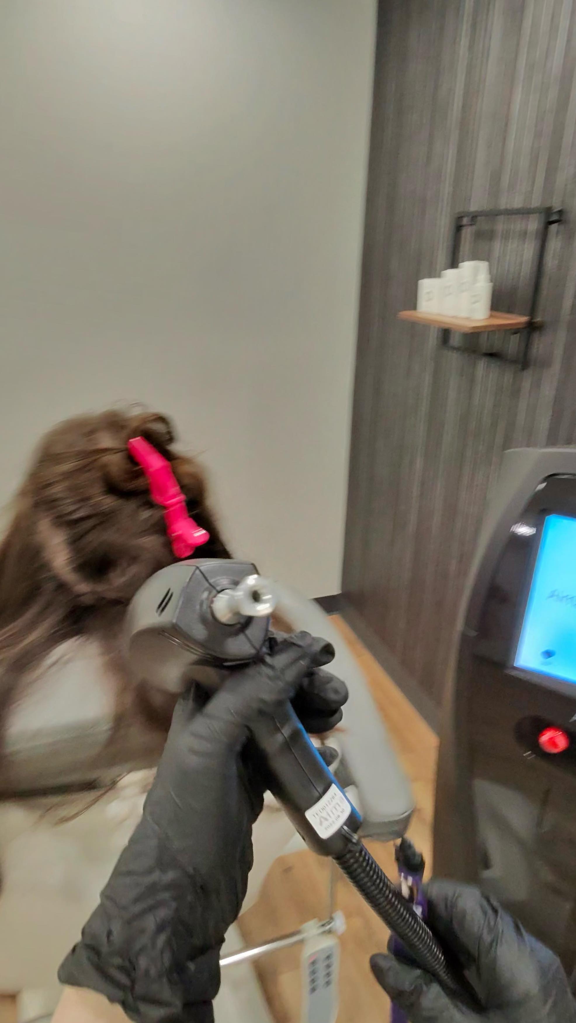 #POV Do a TED treatment with me in 30 seconds. Look how healthy and shiny her hair is ๐ป
#hairrestoration #hairhealth #hairgoals