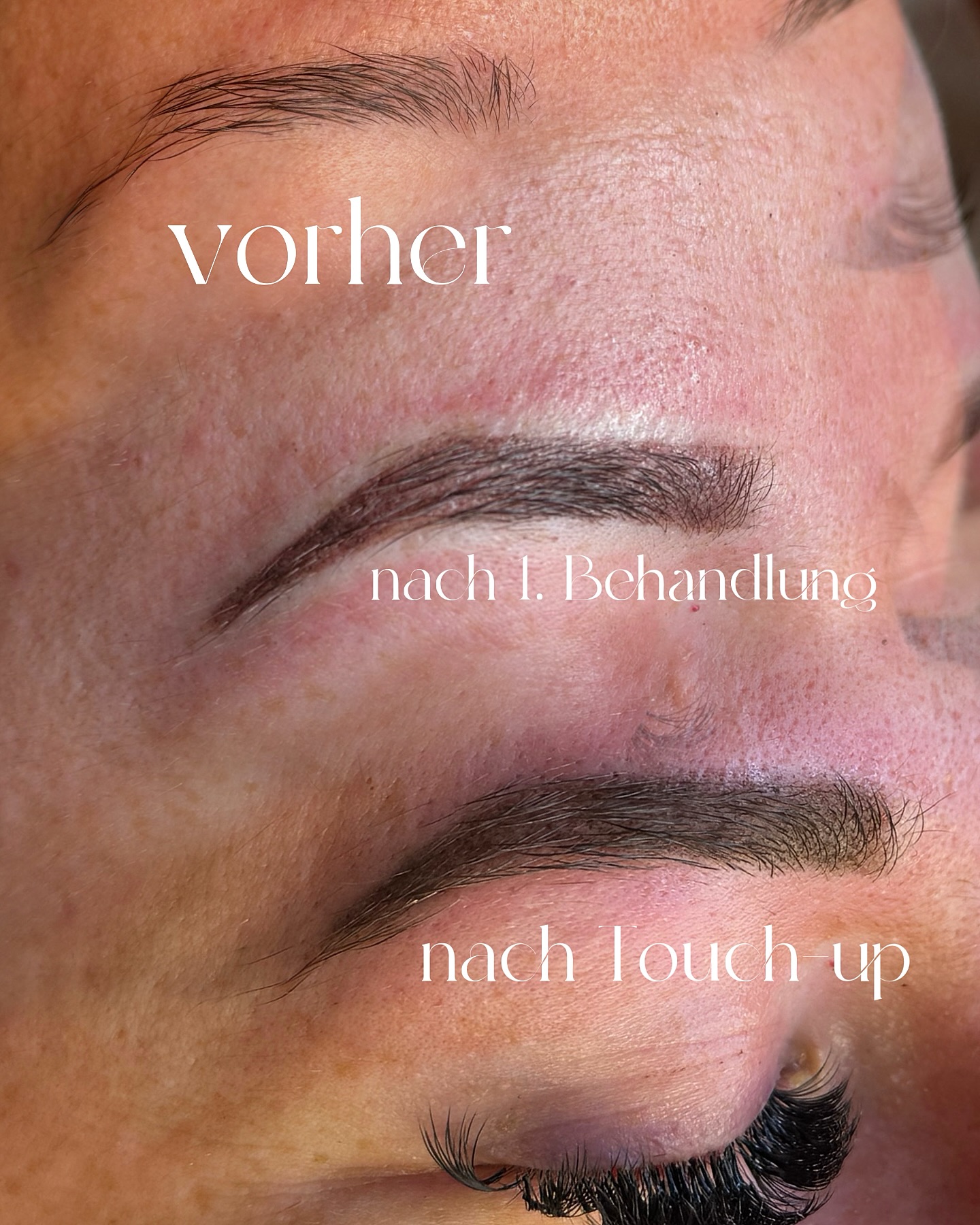✨ Ombre Brows – Individuell nach deinem Wunsch! ✨
Ombré Brows sind perfekt anpassbar – von super soft bis intensiver definiert! Hier siehst du, wie wir die Farbintensität je nach Kundenwunsch steigern können.
✅ Sanfter Verlauf für einen natürlichen Look
✅ Mehr Intensität für definierte Augenbrauen
✅ Perfekt abgestimmt auf deine Gesichtsform und deinen Stil
#OmbreBrows #PermanentMakeup #AugenbrauenPerfektion #Beauty #pmubrows #pmu #browartist #labina