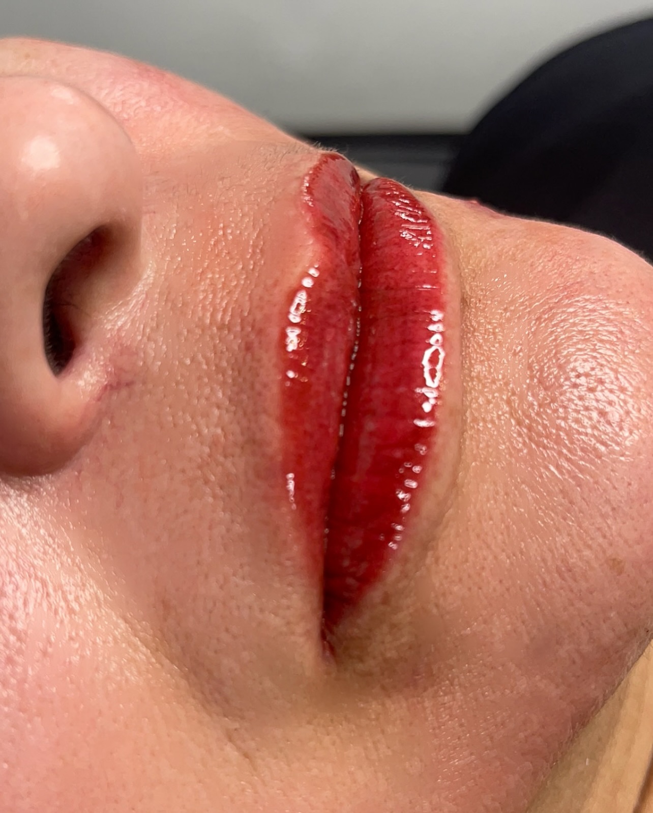 👄 Lip Blush🫦💋
Do you desire to have symmetrically tinted lips?!… Then our Lip Blush service is the ultimate makeup hack for long-lasting gorgeous lips.
Our client opted for a berry mauve lip hue and we are estatic to see her healed results!
⚠️ Swelling is temporary and will last up to 24-48hrs.
Color will also subside and for natural results. This is a two step process that includes an initial & touchup session.
Click the link in our bio to secure your appointment today🗓️
📍Houston, TX
#lipblush #gorgeouslips #permanentmakeup #lipslipslips #houstonpmu #pmu #beatandblade #swipeleft⬅️