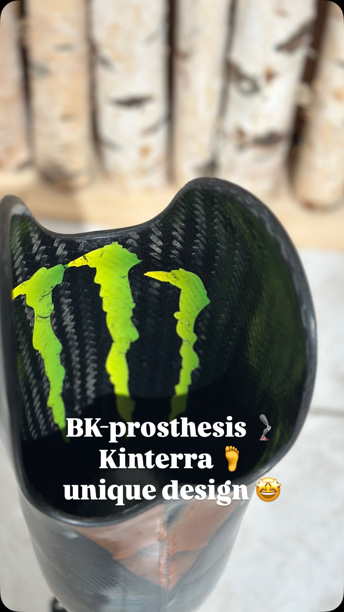 Hier entsteht eine Unterschenkelprothese für unseren Kunden @marios_ebikegarage . Nach der Amputation war für ihn klar: „weiter geht’s“. Das Design war sein spezieller Wunsch.
So macht der Beruf Spaß: wenn sich der Kunde positiv und konstruktiv in die Versorgung einbringt.
Danke Mario für dein Vertrauen in unsere Leistung und deinen Willen und Ehrgeiz um wieder schnell auf beiden Beinen stehen und gehen zu können! Einfach stark wie du Gas gibst 💪🦿
#orthopädietechnik #handwerksstolz #meinhandwerkhilft #oandp #custommade #handarbeit #handmade #unterschenkelprothese #bkprosthesis #prothese #prosthesis #danke