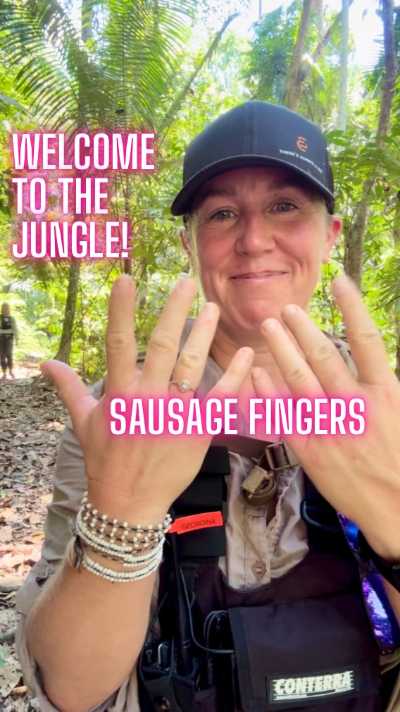 Heat oedema is really common when travelling to a tropical climate from a more temperate one. It manifests in the extremities with swollen feet and swollen hands (aka sausage fingers!)
So why does it happen?
Blood flow increases to the skin through widening (vasodilation) of the blood vessels which is a way of shedding heat and staying cool. As a result of this, fluid leaks into the surrounding tissues causing swelling (oedema).
Gravity is your friend here - elevating the hands and feet can really help. It normally completely settles in a few days as your body acclimatises to the heat.
#expedition #wildernessmedicine #remotemedicine #junglemedicine @secret.compass @worldextrememedicine