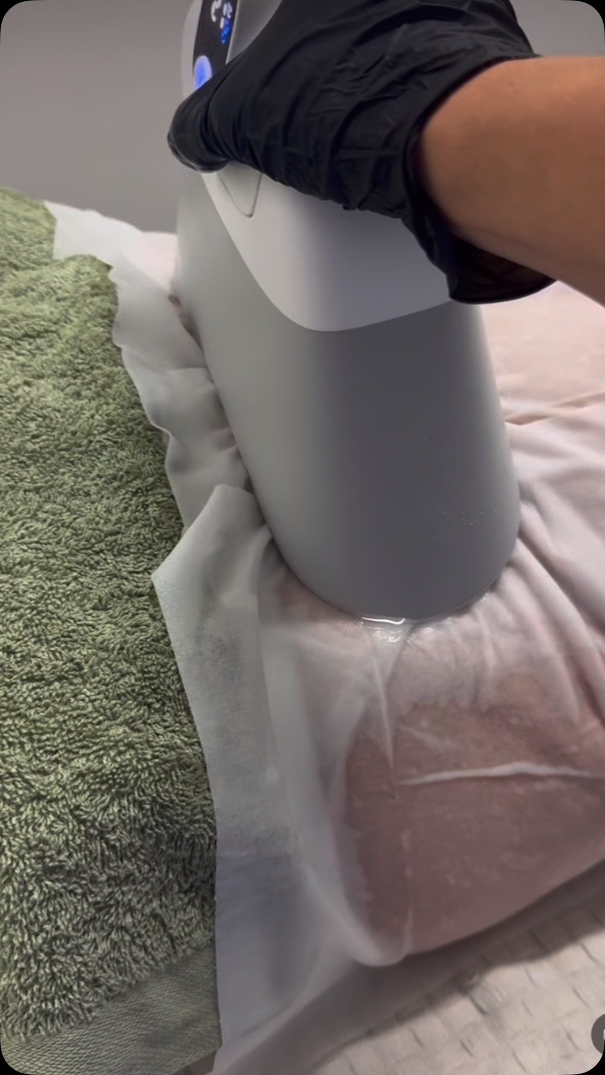 Everyone is talking about the new CoolSlimming Ultimate 360ยฐ machine, itโs the most advanced fat freezing machine available to date!
This machine has brand new upgraded technology with 13 Medical Grade Covered Silicone Grip Applicators for every area at every angle. There is no other machine on the market to rival it!
Here are the reasons why:
๐ 13 Covered Silicone Grip Applicators for Any Area
๐ Fast and Easy Applicator Exchange
๐ Any Treatment Area at Any Angle
๐ Anti Bruise Technology
๐ Silent Mode (much quieter than previous models)
๐ Upgraded 360ยฐ Surround Cooling angle
๐ 300% Increased Coverage with selected applicators
๐ Treat 4 Areas At The Same Time
๐ Up to 40% Fat Reduction Per Treatment
๐ Smart Pre Set technology
๐ One button touch start (no need to stabilise treatments anymore)
Trade in your old CoolSlimming Device and always keep up to date with current technology and offer the best possible results to your clients.
Contact us for more information ๐ฒ