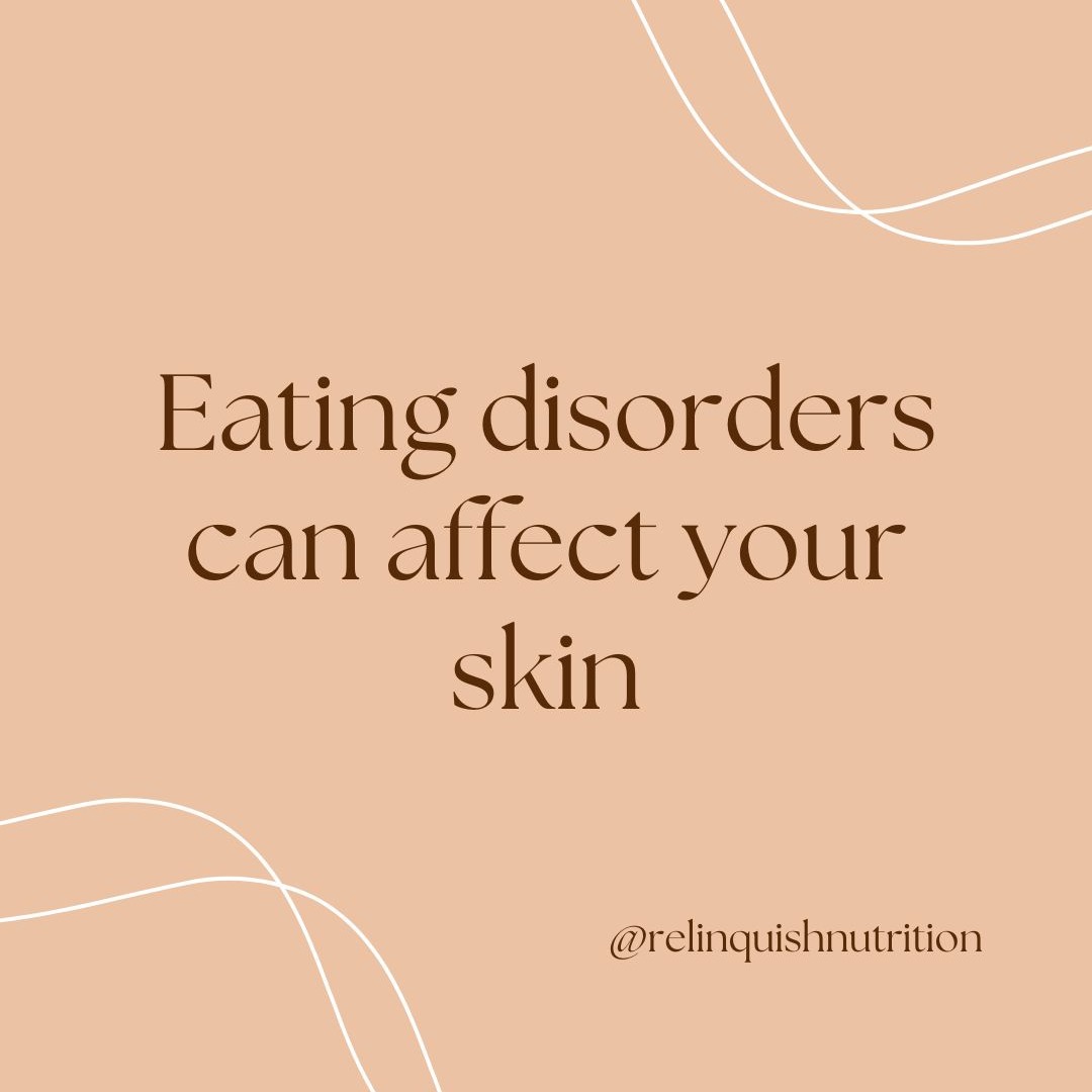 Eating disorders can impact your skin's appearance but also it's ability to keep you well.