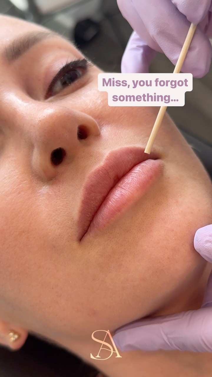✨ Just a little lip sprinkle ✨
Using a small amount of lip filler to balance out her lips and refine her natural asymmetries.
💕Ready to book? DM us
#lipgloss #lipfiller #pout #lips