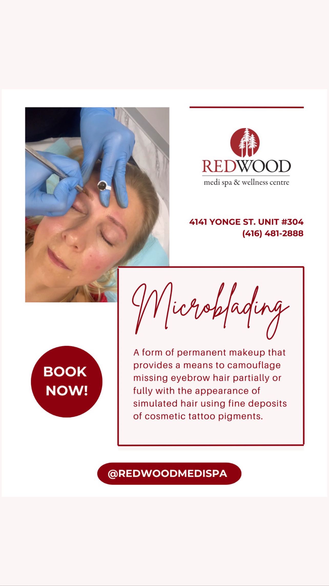 Interested in a treatment that gives you the most bang for your buck?
Microblading is for you! It simulates eyebrow hairs using fine deposits of cosmetic tattoo pigments, completely eliminating the need to manually touchup your eyebrows on your own ⭐️ Results typically last between 12-30 months, making the procedure very worthwhile!
Call now to book your free consultation 📞 We look forward to seeing you! ❤️