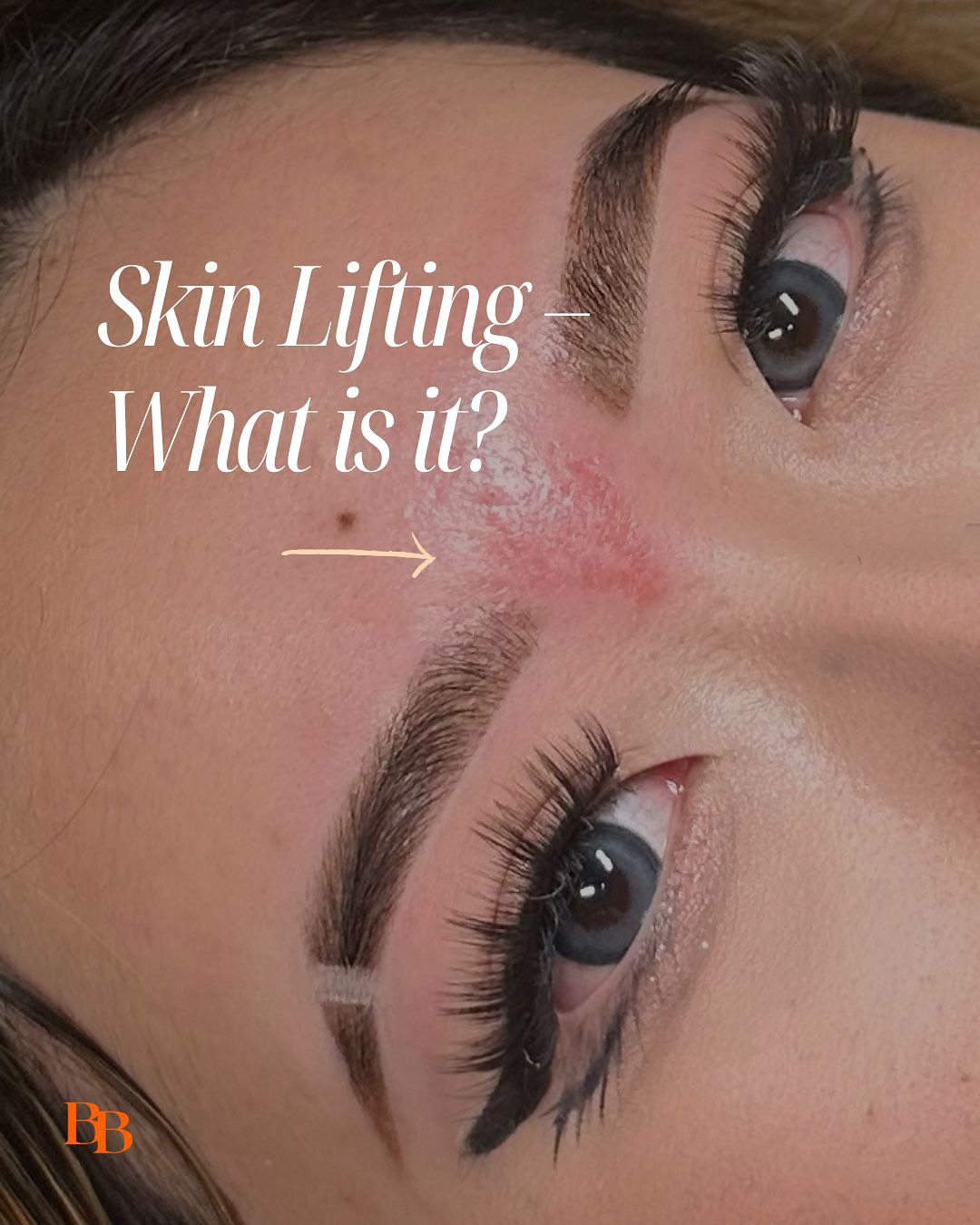 Let’s talk about skin lifts! 🫣🩹
When this happens it’s usually a sign that your skin needs ✨extra care✨ before waxing!
Avoid exfoliating, active ingredients, stay hydrated (lots of water and moisturise!!) and update your brow artist about any new skincare products you’re using or facial treatments you’re getting.