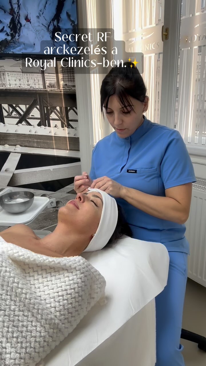 Secret RF arckezelés a @royalclinics -ben @kitti_voros_ -nél. 🤩✨#reklám
A Royal Clinicsbe járok már egy jó ideje arckezelésre Vörös Kittihez és most kipróbáltam a Secret RF mikrotűs arcfiatalítást.😉✨Kitti mindig tudja, hogy az arcomnak éppen milyen kezelésre van szüksége, maximálisan megbízom benne. Fun fact: 2025. március 31-ig 20% kedvezménnyel próbálhatod ki ezt a mikrotűs kezelést.
Lifting és felületmegújítás rádiófrekvenciával kombinálva.
A kezelés hatásai:
* egyenletesebb bőrfelszínt
* csökkenti a ráncokat, feszesíti a bőrt
* összehúzza a pórusokat
* kezeli a tágult ereket, a kipirosodást
* halványítja a pigmentációt
* volumennövelő, lifting hatással jár
#rf #radiofrekvencia #arckezeles #mikrotu #royalclinics