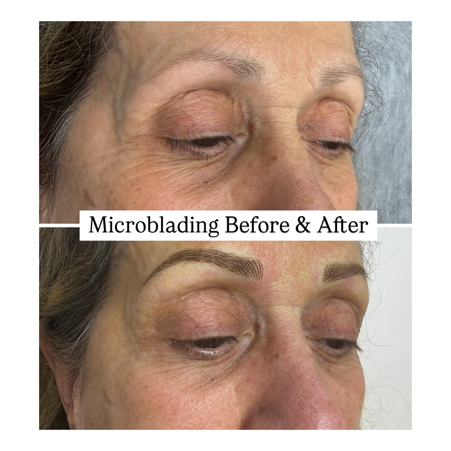 Obsessed with this eyebrow transformation!
This treatment completely gives this client a lift and boost to create a youthful appearance ✨
If you’re having thoughts about doing this treatment but worried that it will not look natural, Selfish is the place to go! We specialize in natural looking microblading that suits everyone 🤍
Book your free consultation 🫶
Call us at 905-850-5899 or book online though our link
#brows #microbladingvaughan #microbladingtoronto #eyebrowsvaughan #skincare #beautytips #vaughanbeauty #torontobeauty #richmondhillbeauty #aerolase #microbladingtraining