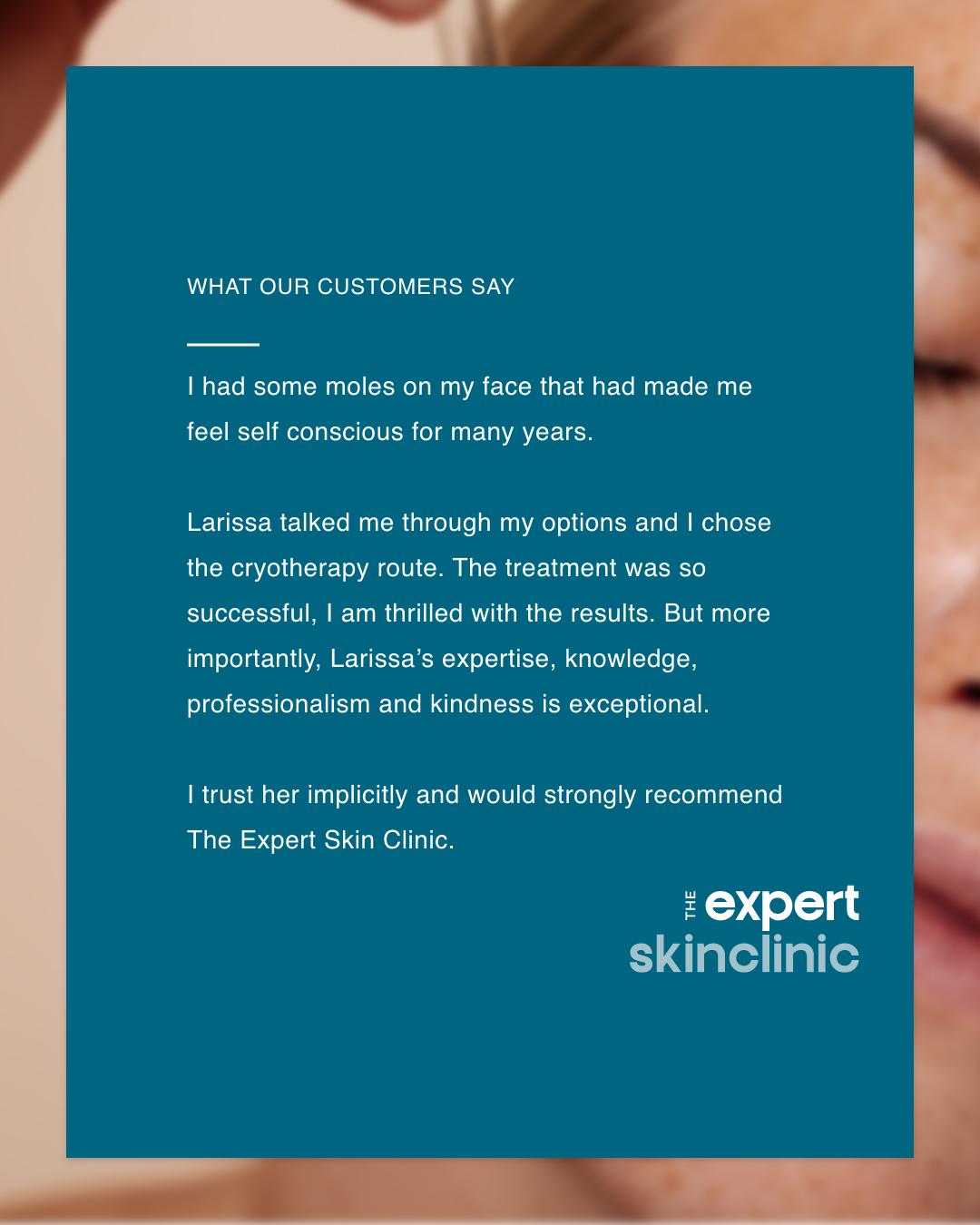 A wonderful review from a recent mole reduction⭐
We've been talking a lot about mole reduction recently since the introduction of Map My Mole.
This client came for a consultation with a moles on her face that were making her feel self conscious. After an examination that these moles were safe to remove, we went ahead and she's happier than ever!
We love helping people regain their confidence but your safety is the most important thing and we will never remove a blemish unless we can be sure it's safe to do so.
If you're unsure what your blemish is and if it can be removed or reduced, book a consultation with us and we can examine it and recommend the best course of action.
#moleremoval #molereduction #blemishremoval #moleremovaltreatment #moleremovalnorthampton #northamptonskin