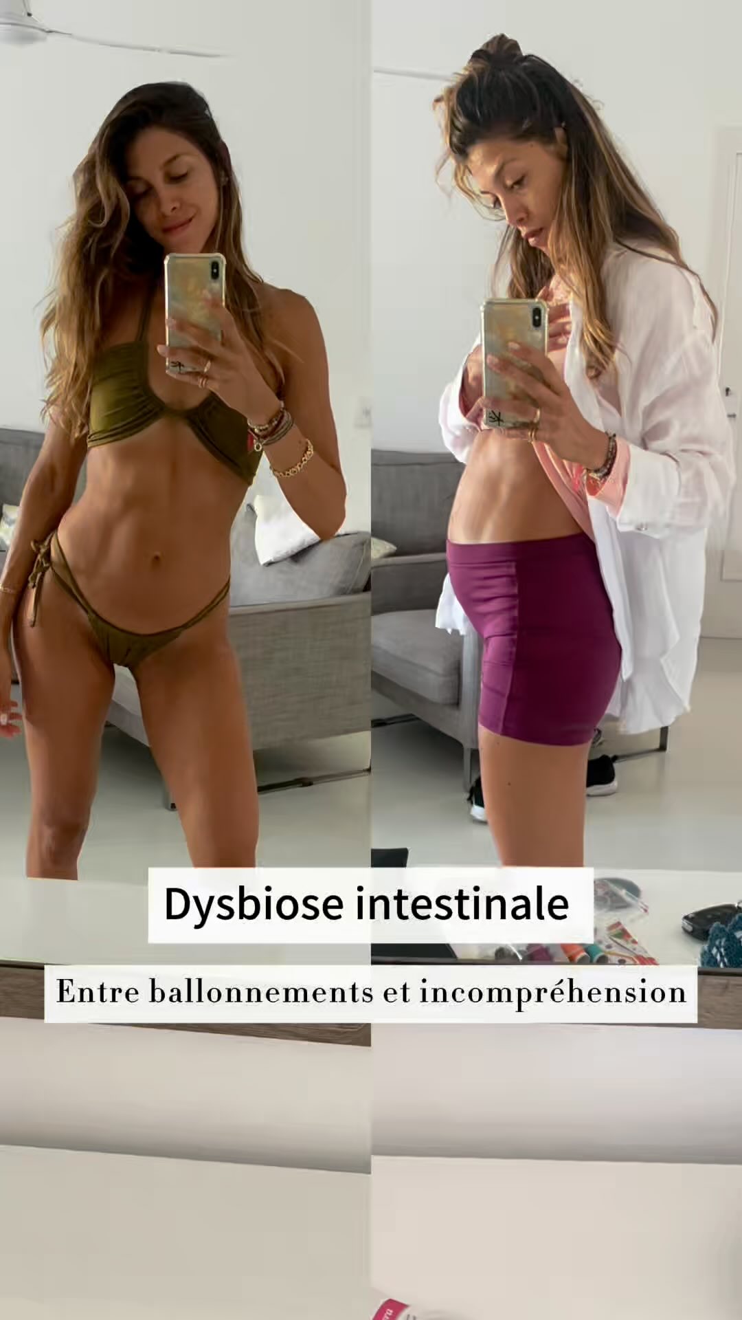 ✨Quand ton corps devient un mystère…✨⬇️
Est-ce que toi aussi tu t’es déjà demandé :
❓ Pourquoi j’ai le ventre tout le temps gonflé ?
❓ Pourquoi j’ai mal après chaque repas ?
❓ Pourquoi je ne digère rien, alors que les autres mangent de tout sans souci ?
Moi ça fait des années que je me pose ces questions.
Ce que tu vois en image ce n’est pas une transformation avant/après… Ce sont des ballonnements.
J’ai toujours fait attention à mon alimentation. Intolérante au gluten et au lactose, j’avais déjà un régime très équilibré et sain.
Mais après plusieurs intoxications alimentaires, tout a changé.
Mon ventre a commencé à gonfler après chaque repas…
Et ça ne s’est plus arrêté.
Après des années à lutter contre une inflammation chronique, le diagnostic est tombé : dysbiose intestinale.
Et ça implique quoi ?
👉🏼Des douleurs chroniques
👉🏼Une fatigue extrême
👉🏼Un épuisement mental
Ça bouleverse tout.
❌ Manger devient un défi : tout me ballonne.
❌ M’entraîner comme avant ? Impossible : moins de force, moins de cardio.
❌ S’habiller librement ? Oublie.
❌ Même dormir ne m’apporte plus de repos.
❌ Et lors des pics inflammatoires qui durent des mois… je ne reconnais plus mon corps.
Les poussées inflammatoires me volent mon énergie, mon sommeil, mes projets…
Mais je refuse d’abandonner. 💪🔥
✨Parce que la santé, c’est la vie !
✨Parce qu’on est bien plus que nos épreuves.
✨Parce qu’il y a toujours une solution… même si elle demande de se battre, chaque jour.
Aujourd’hui, je commence une nouvelle phase de traitement., alliant micronutrition, médecine, phytothérapie, ostéopathie et nutrition etc.
Si ce sujet t’intéresse, je vais partager davantage de contenu sur la dysbiose intestinale et mon parcours, en plus de mes posts habituels sur la sur la nutrition et la musculation. 💙
Si tu vis ça ou passe par un moment difficile, tu n’es pas seul. ❤️
Partage ce message à quelqu’un qui en a besoin.
🔹 Abonne-toi pour ne rien manquer !
#santéintestinale #nevergiveup #nutrition #fitgirl #dysbiose #guthealthmatters #fitnessmotivation #mindset #sansgluten #ballonnements #resilience #guthealing #musculationfemme #fitness #motivation