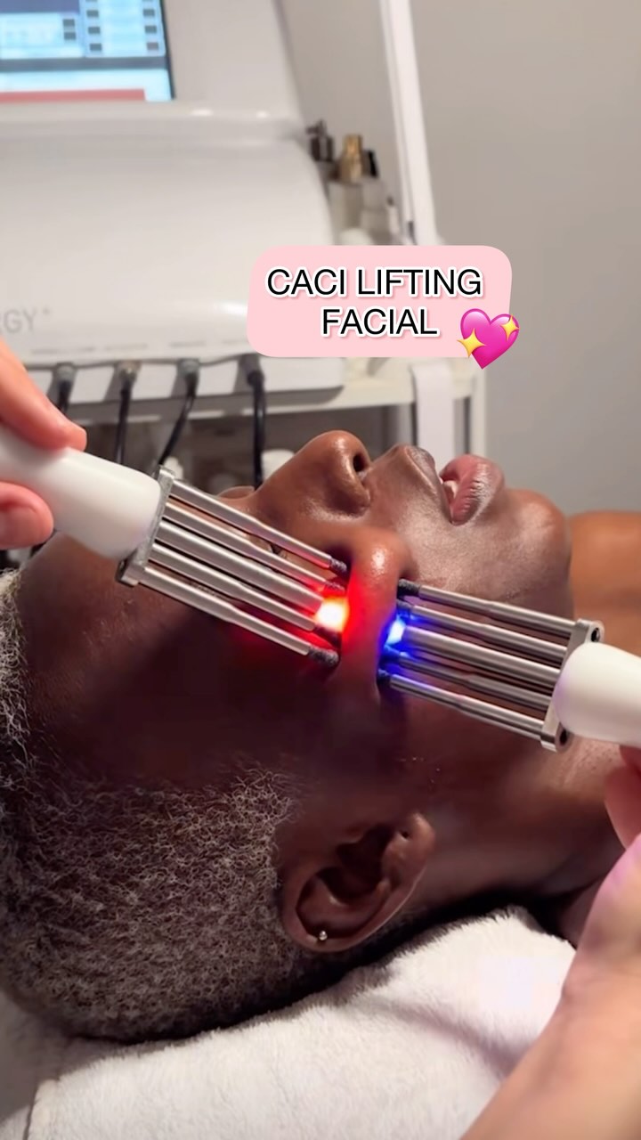 Lift, tone, and glow with our CACI facials! ✨ Using advanced microcurrent technology, CACI stimulates facial muscles, boosts collagen, and enhances skin elasticity.
Say goodbye to fine lines, wrinkles, and sagging — it’s like a non-surgical facelift with no downtime!
Ready to experience a youthful, radiant complexion? Book your first session today and see your results develop!
Have questions? Feel free to contact us — we’re happy to help! 💆♀️
#CACIFacial #SkinRejuvenation #NonSurgicalFacelift #GlowUp #BeautyTreatments #SkincareLondon #SalonLife #BeautyExperts #LuxuryFacials #SheenBarnesSalon #HairAndBeauty #PamperYourself #SelfCareLondon#BeautyInLondon #WellnessLondon #LondonAesthetics #BeautyTherapy #EastSheenVillage #DermalogicaPartner #CACIPartner #BarnesCommunityAssociation #MortlakeToPutney #AustralianBodycarePartner