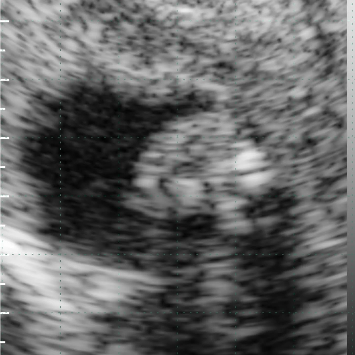 Kannst du etwas auf diesen Bildern erkennen? Hier versteckt sich unser Nachwuchs für dieses Jahr. Wir haben den heutigen Vormittag genutzt um ein weiteres Mal Ultraschall bei unseren Stuten zu machen. Die Freude ist groß, denn wir dürfen uns dieses Jahr wahrscheinlich über fünf Fohlen freuen. Nur bei Jacira war ich mit dem Foto nicht schnell genug 😅 dabei ist das Fohlen schon so weit,dass es mich fast angegrinst hat. 🦙🦙🦙🦙🦙😍