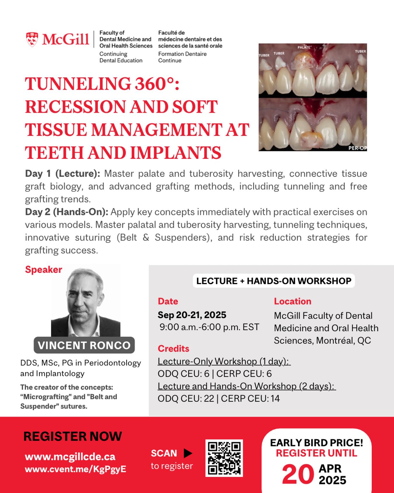 NEW COURSE ALERT! 🚨
Looking to master soft tissue management and elevate your perio & implant practice? Join Dr. Vincent Ronco for an exclusive 2-day in-person course on Tunneling 360°: Recession and Soft Tissue Management at Teeth and Implants – From Theory to Practice! 🦷✨
📅 Date: September 20-21, 2025
📍 Location: McGill Faculty of Dental Medicine and Oral Health Sciences
🎓 Earn up to 22 CE Units
Day 1: Lecture Only (September 20) – 6 CE Units
Gain a deep understanding of:
🔹 New harvesting techniques from the palate & tuberosities
🔹 The biology of connective tissue grafts
🔹 Root substance loss management with grafting
🔹 Tunneling-based grafting concepts & clinical applications
Day 2: Hands-On Workshop (September 21) – 16 CE Units
Refine your skills through intense practical exercises on:
🔹 Palatal & tuberosity harvesting
🔹 Tunneling procedures (sulcus & lateral buttonholes)
🔹 Innovative suturing techniques: “Belt & Suspenders”
🔹 Submerged, exposed & partially exposed graft procedures
Don’t miss this opportunity to learn from Dr. Vincent Ronco, the creator of the concepts: “Micrografting” and “Belt and Suspender” sutures!
Early Bird Pricing (until April 20, 2025)
Register now: www.mcgillcde.ca or https://cvent.me/KgPgyE
#DentalCE #SoftTissueGrafting #ImplantDentistry #Periodontics #McGillCDE
