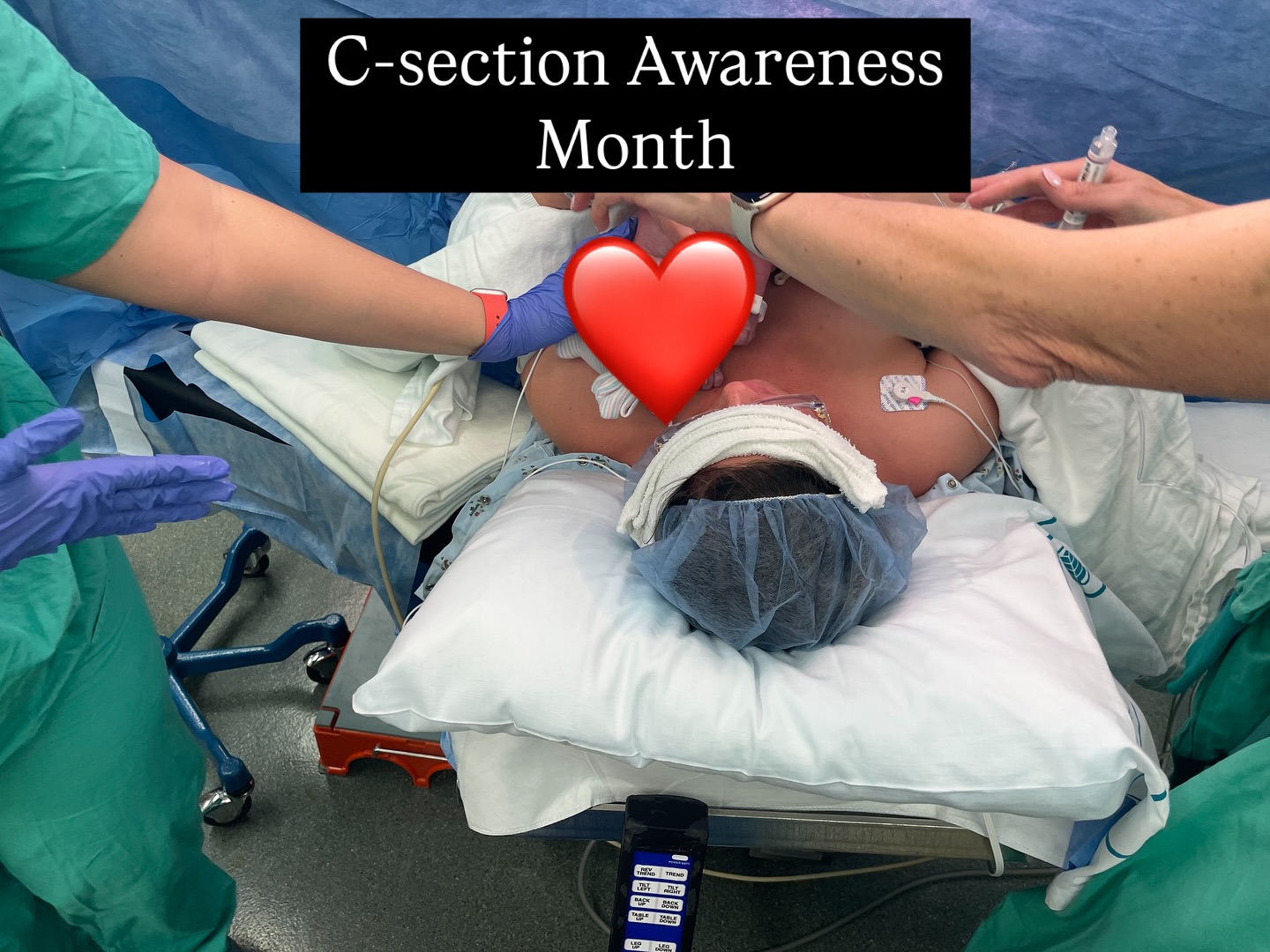 April is Cesarean Awareness Month
The road to recovery after a cesarean looks different for everyone. Physical therapy can be a great avenue to assist in this journey whether you’re looking to reduce scar sensitivity, lift your baby without pain, return to exercise or just find out “is this normal?”.
Tranquility makes it a little bit easier by coming to your home to start education and pain management as soon as possible.
I return April 7th - send me a message if you’re interested in learning more!
P.S This song was my husband and Is first dance, but it’s also the song that played while our child was born. ❤️
#pelvicfloorphysicaltherapy #cesareanbirth #cesareanawarenessmonth