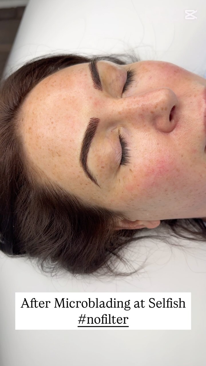 Enhance your appearance, boost your confidence & save your precious time!
This amazing treatment can do it all 🤍 Book your free consultation to get all the details you need to feel your best everyday 🫶
#microbladingvaughan #aerolase #microblading #beauty #skincare #beautytips #microbladingwoodbridge #skinrejuvenation #brows #eyebrows