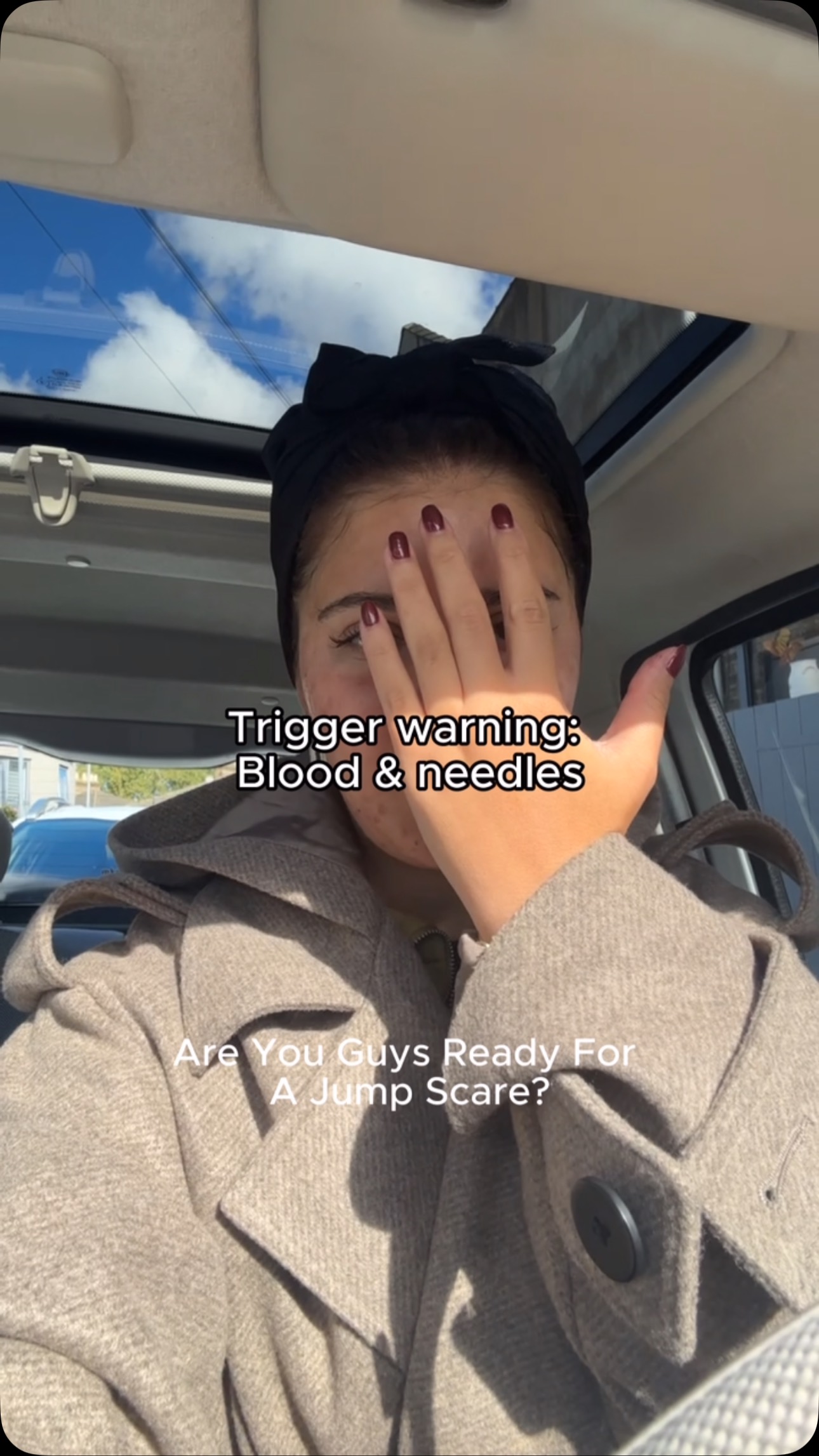 Real skin, real results ✨ There’s nothing we love more than seeing our clients glow!
@z_kadhum popped into the clinic last month for a session of PRP (aka the ‘liquid gold’ facial) to help refresh tired skin, help with acne scarring, and restore that healthy, radiant glow. And the results absolutely speak for themselves!
📣 For a limited time, when you book a full course of PRP, you’ll receive a COMPLIMENTARY skin booster session as part of your treatment plan.
📩 DM us or tap the link in bio to book your consultation with Nurse Coral today.