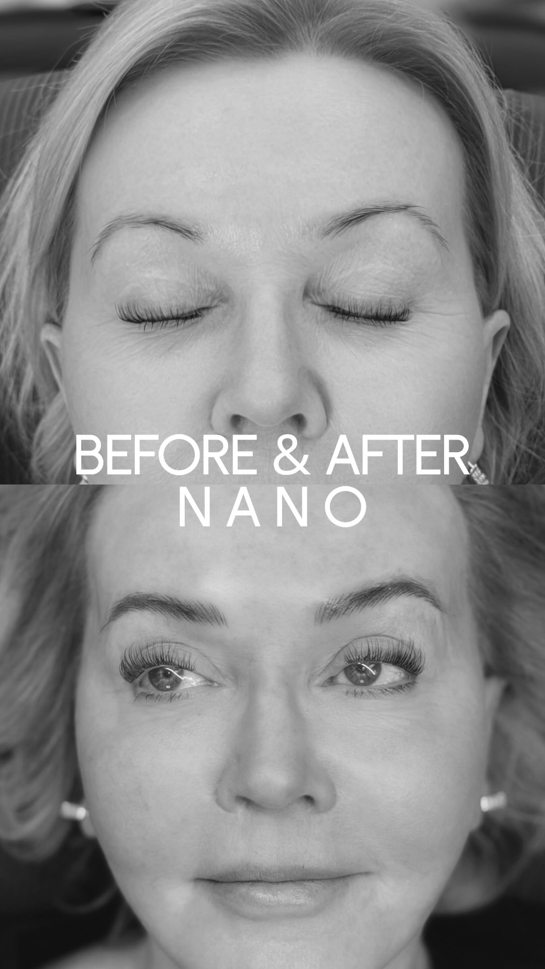 NANO BEFORE & AFTER ✨ // Now is the perfect time to get your eyebrows summer ready! Book your appointment today 🤍
#pmu #pmuartist #nano #eyebrows #beforeandafter #northvanbeauty #glowup #microblading