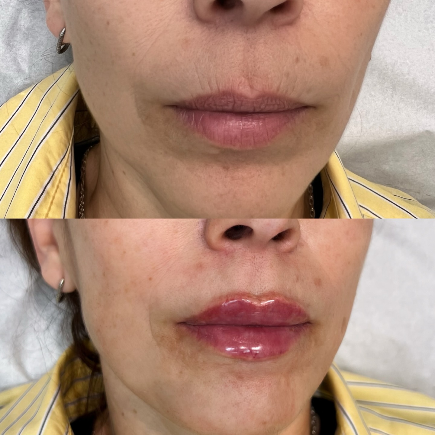 Un glow naturel… mais version lèvres ! Hydratation, volume et définition : le combo parfait pour un sourire irrésistible. ✨✨👄