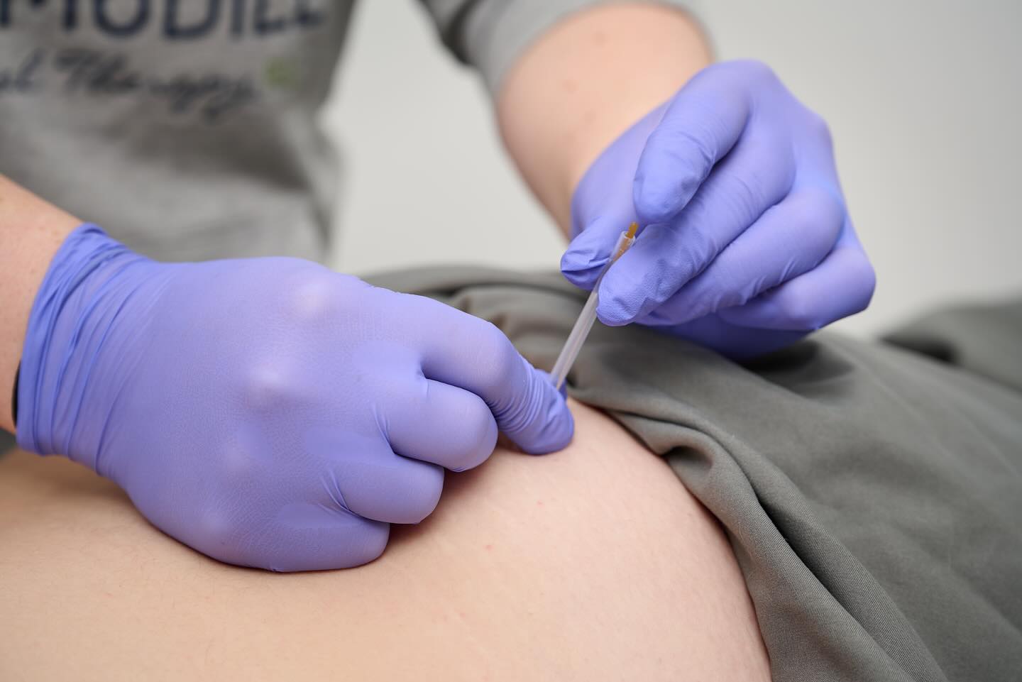 Dry needling can be a great treatment option to help with musculoskeletal pain and tightness.
Although the types of needles used are the same as acupuncture, the treatments are very different.
Interested to see if dry needling would make a difference in your recovery? Book an appointment using the link in our bio.
#physicaltherapy #dryneedling #staymobile #recoverbetter #newhampshire #londonderrynh