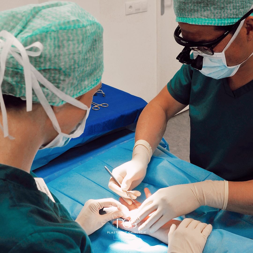 Heeft u een pijnlijk en prikkend gevoel in de duim, wijsvinger en middelvinger? Dan heeft u mogelijk het Carpaal Tunnel Syndroom. Het Carpaal Tunnel Syndroom kan met een kleine ingreep, waarbij er een snede in de handpalm wordt gemaakt, worden verholpen. De dwarse polsband wordt doorgesneden waardoor de ruimte rond de zenuw wordt vergroot en de zenuw weer normaal kan functioneren.
Wilt u meer informatie betreft de behandelmogelijkheden voor het Carpaal Tunnel Syndroom? Neem dan snel contact met ons op!
📞: 050 - 211 04 96
💌: info@pcgroningen.nl
