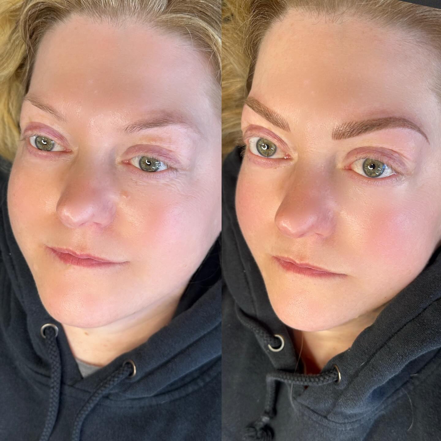 New brows !!! God I just love when someone comes so hesitant (cus let’s get real, a tattoo on your face IS a big deal 🤣) and walks out living her new brows! These will of course soften and since she works so far away we can’t touch up until August so I can’t wait to see them then!!! #brows #yycbrows #yycbrowtattoo #yycbrow